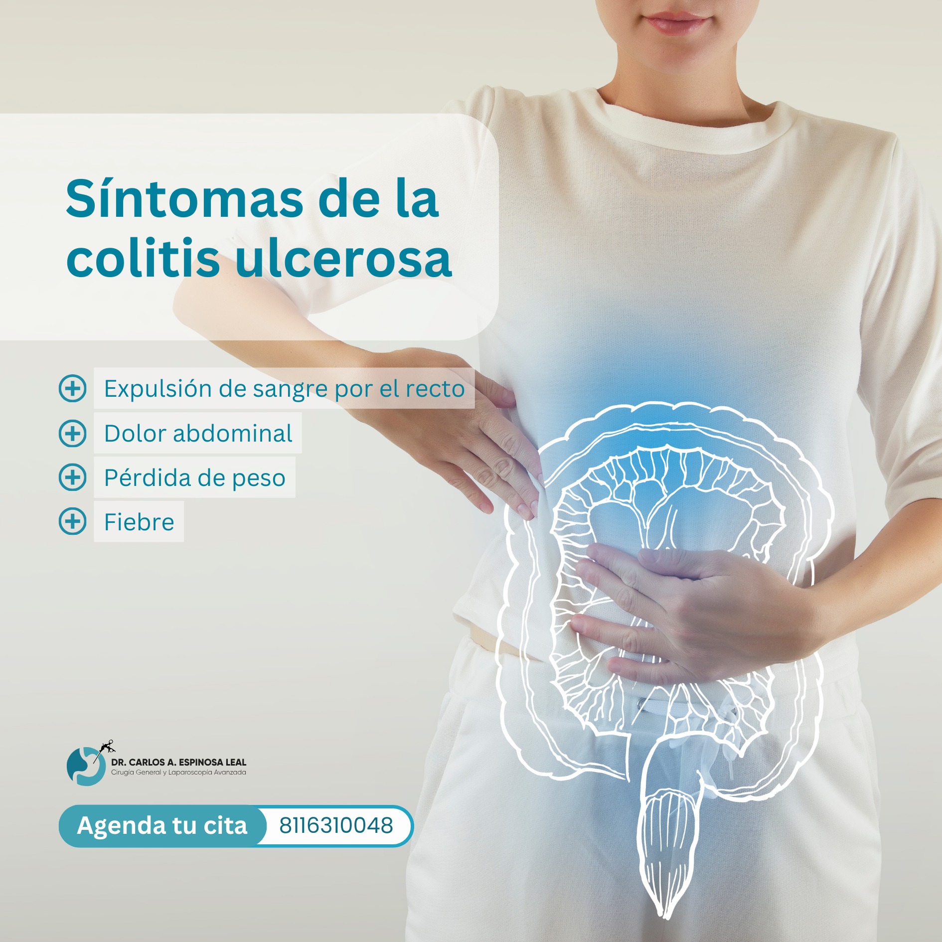 Dr - 🔵 Síntomas de la colitis ulcerosa 🔵 La colitis ulcerosa es una ...