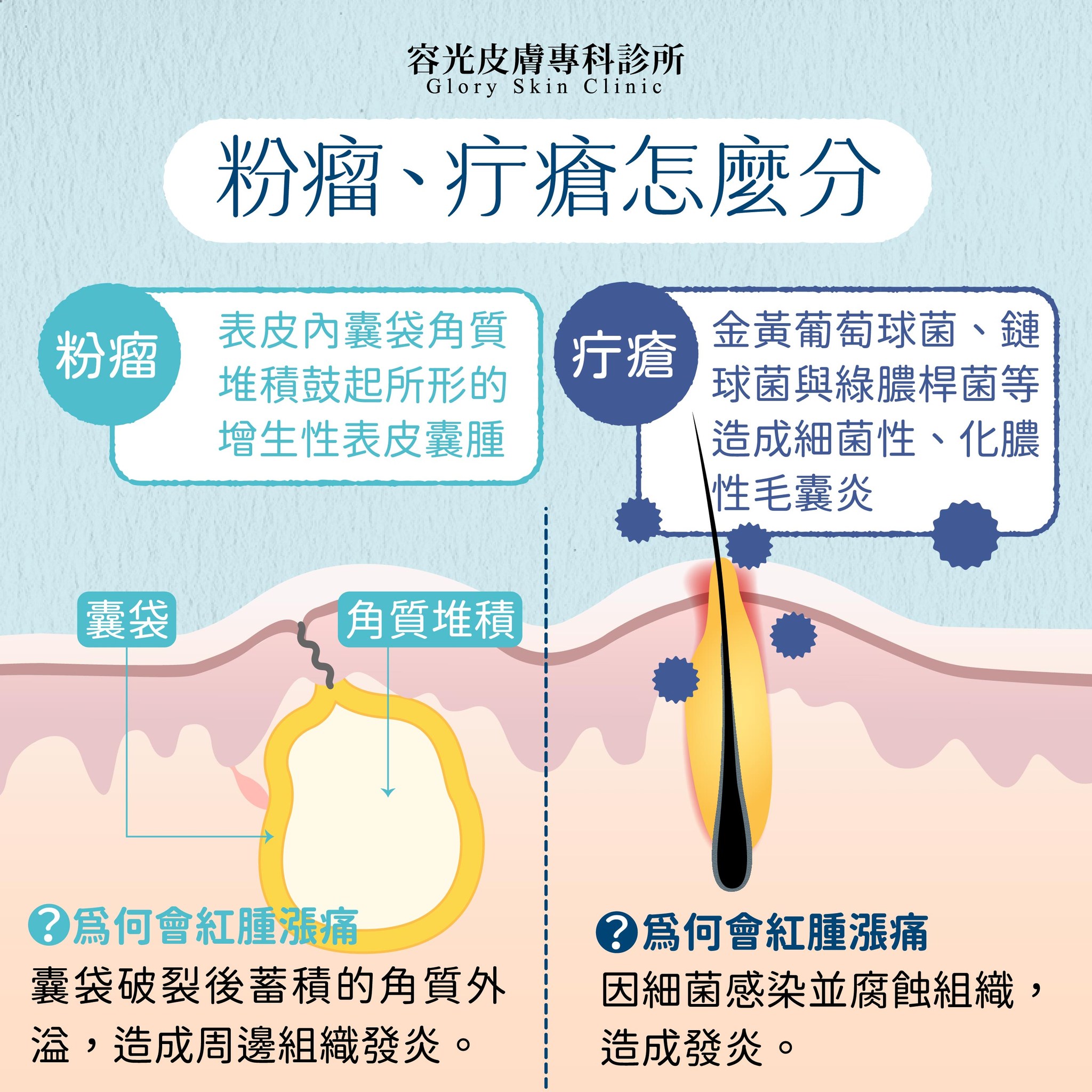 容光皮膚專科診所新店店 - 身上看似冒了爆漿青春痘，卻比痘痘還爆痛😫 粉瘤、疔瘡都會帶來難以忍受的脹痛😢... | Facebook