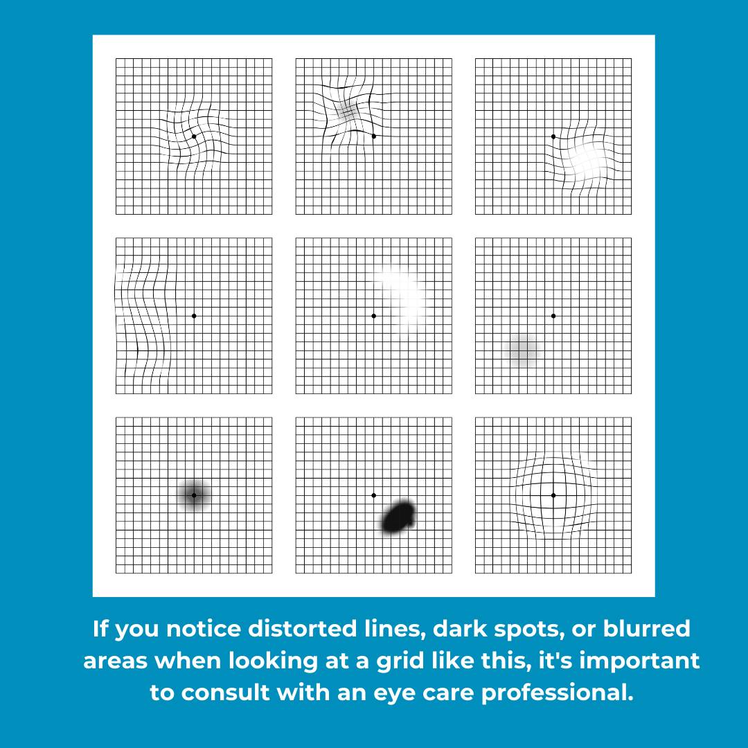Midland Eye - The Amsler Chart is a valuable tool that can... | Facebook