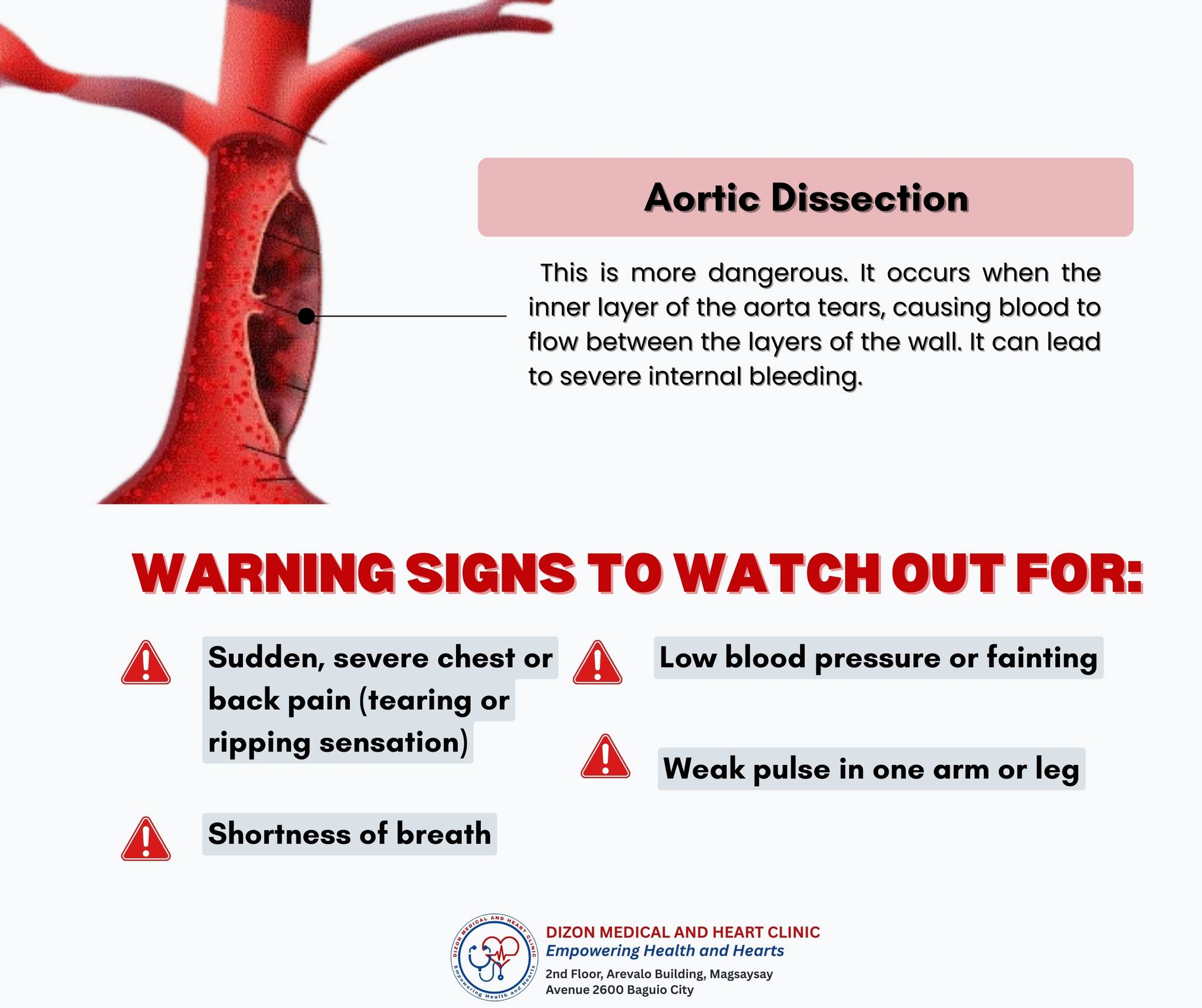 🫀 𝐇𝐞𝐚𝐫𝐭 𝐇𝐞𝐚𝐥𝐭𝐡 𝐀𝐰𝐚𝐫𝐞𝐧𝐞𝐬𝐬:... - Dizon Medical and Heart Clinic | Facebook