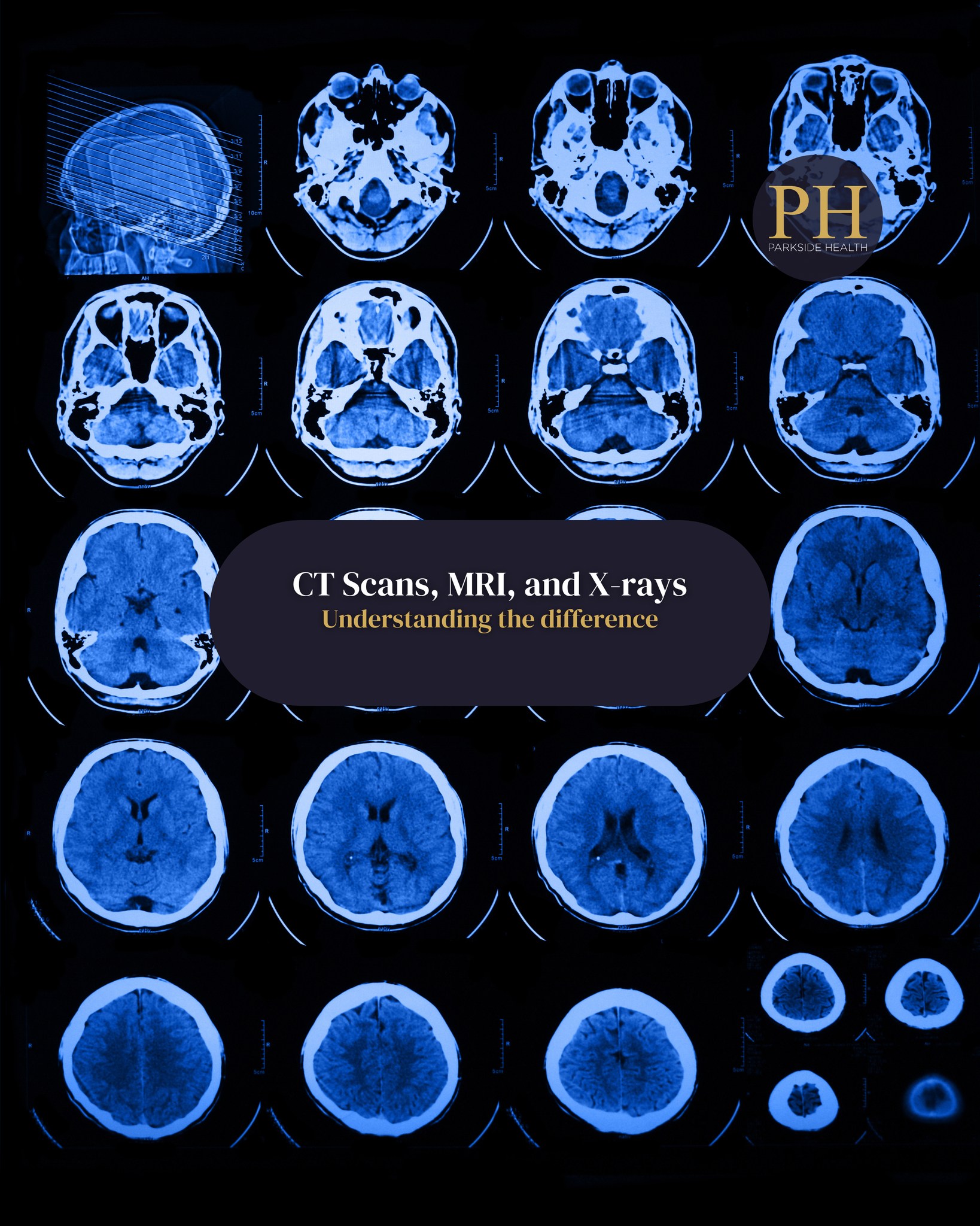 Parkside - CT Scans, MRI, or X-rays? 🤔 Confused about the differences ...