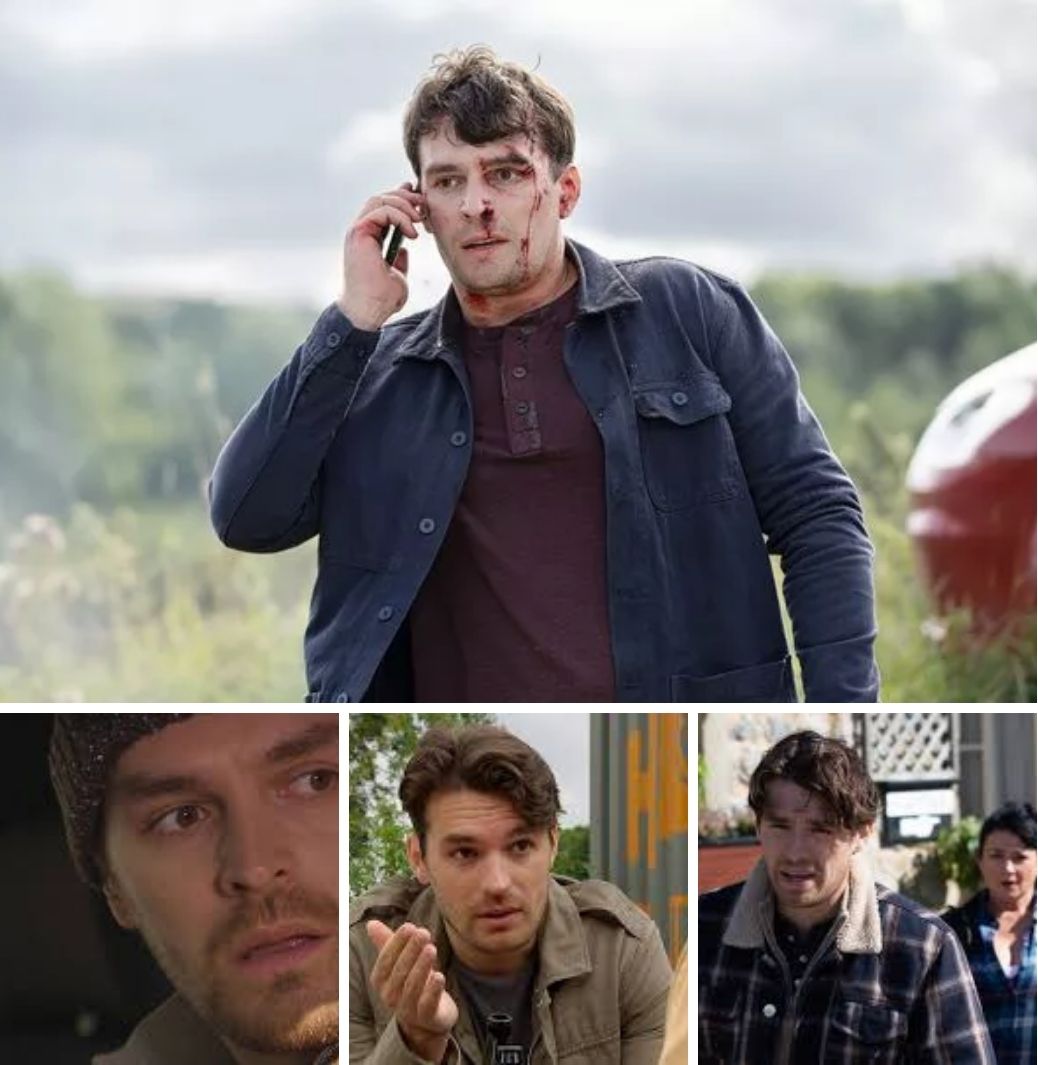 Emmerdale - ANGER ERUPTS! Actor Lawrence Robb, who plays Mackenzie, has ...
