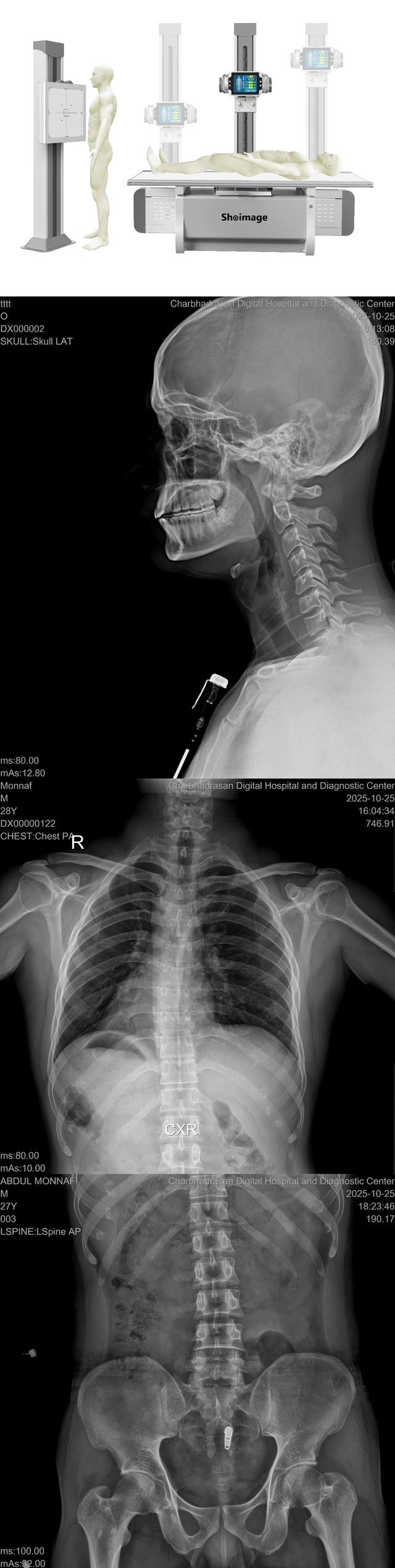 Shoimagemed - 🌍 Advanced Digital Radiography by Shoimage On Oct 25 ...