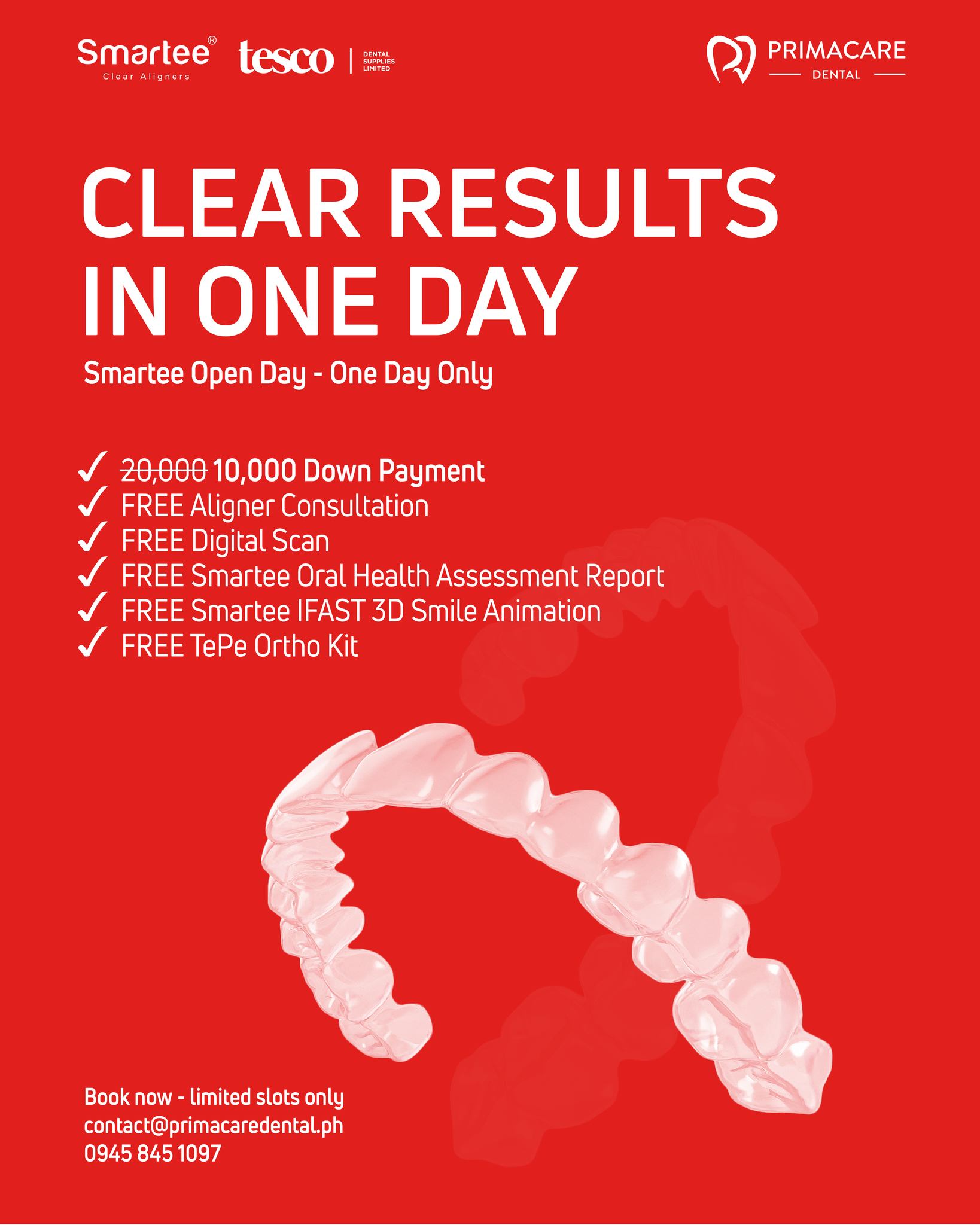 Smartee Clear Aligner Philippines | Makati