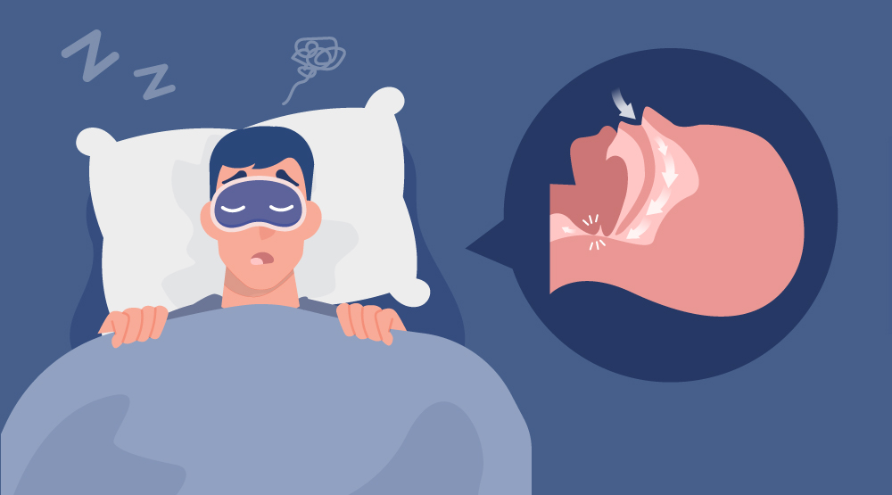 Dr. - 🛌仰睡竟然是加重睡眠呼吸中止症的隱藏幫兇?! 仰睡，也就是平躺睡姿，可以保持脊椎的自然彎曲，減少背痛， 再者，臉部不會壓在枕頭上 ...