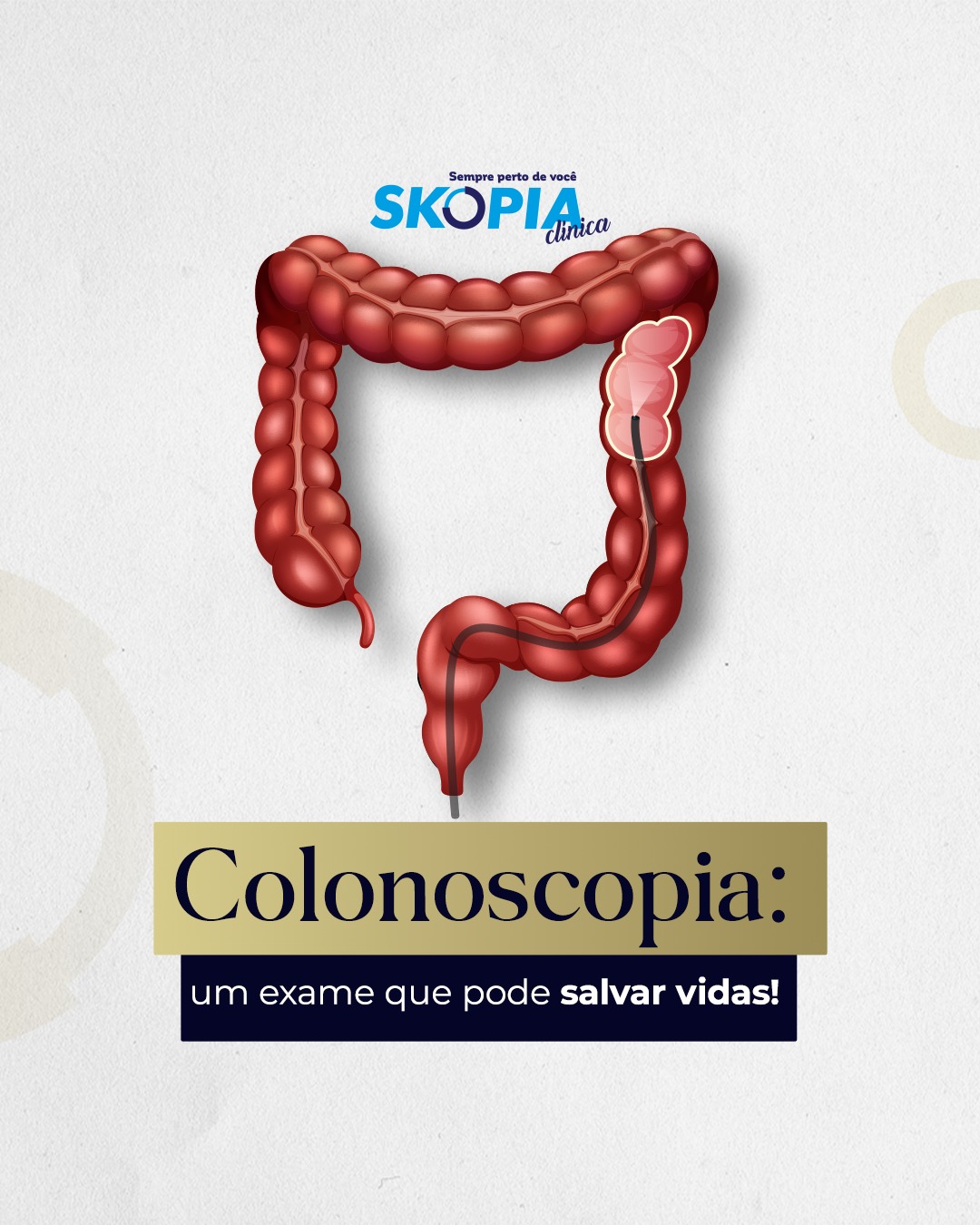 Clinica Skopia - A colonoscopia é fundamental para a... | Facebook