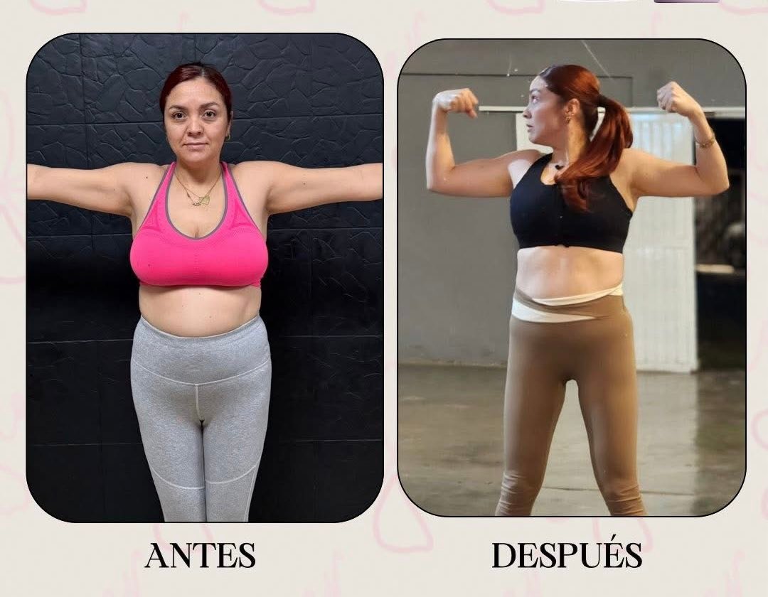 l carnitina antes y despues 👙EXPERIMENTA LOS BENEFICIOS DE NUESTRO COCKTAIL SLIM 👙 Glutatión (60mg): Antioxidante poderoso que desintoxica mejora tu piel. Ácido Alfa Lipoico (100mg): Reduce la inflamación, aumenta la energía y apoya la salud Order glutathione face wash online India Pack:3 Pack B12 Injection Flyer: Med