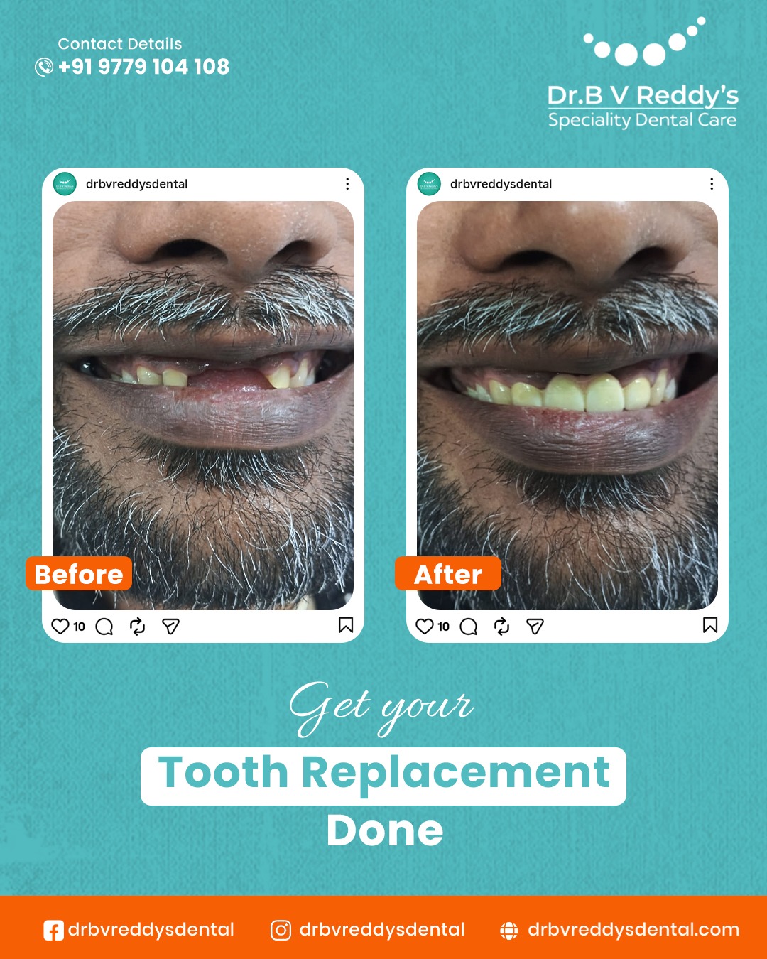 Dr. B V Reddy's Speciality Dental Care | Bachupally
