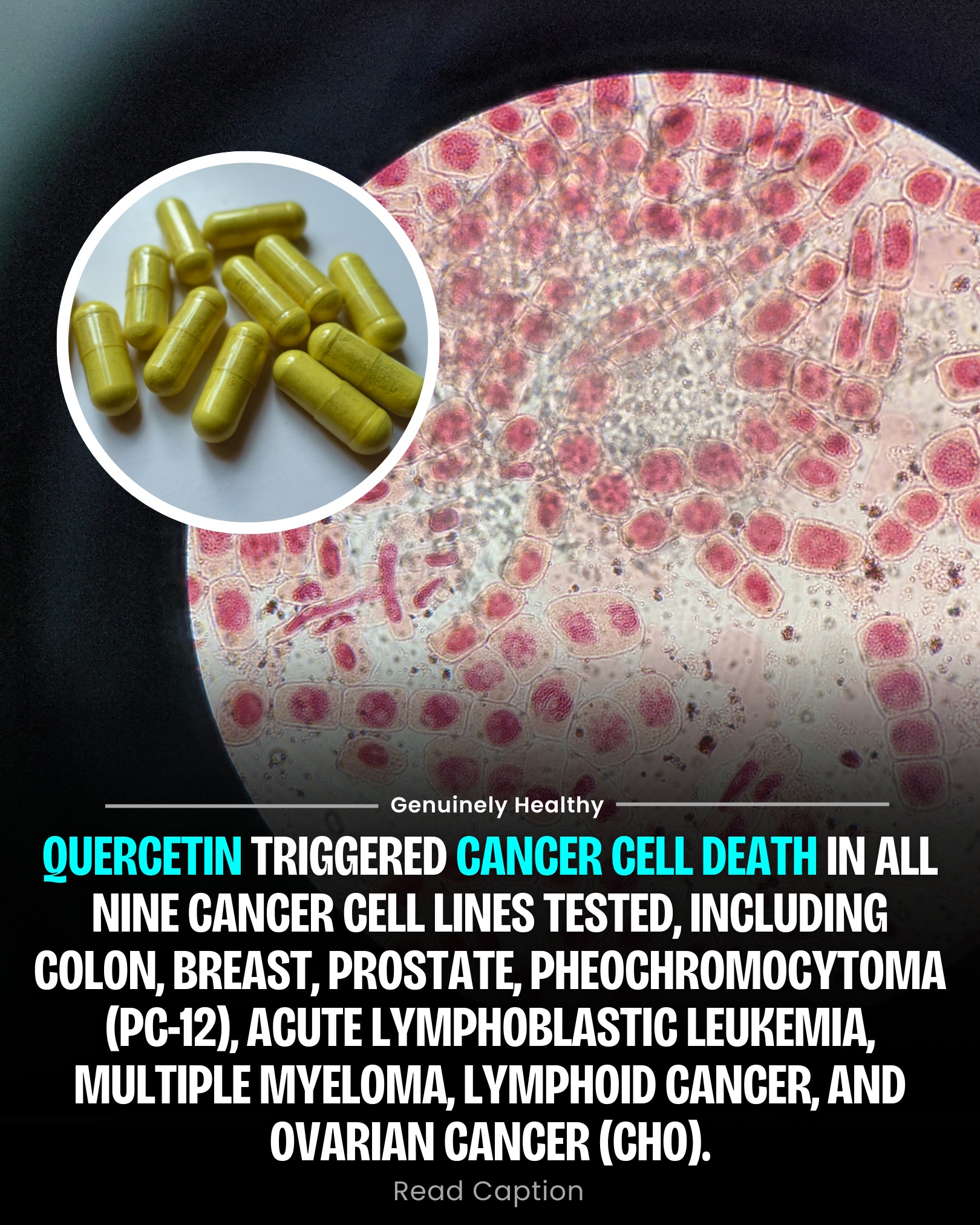 A study published in the Journal of Ovarian Research (2022