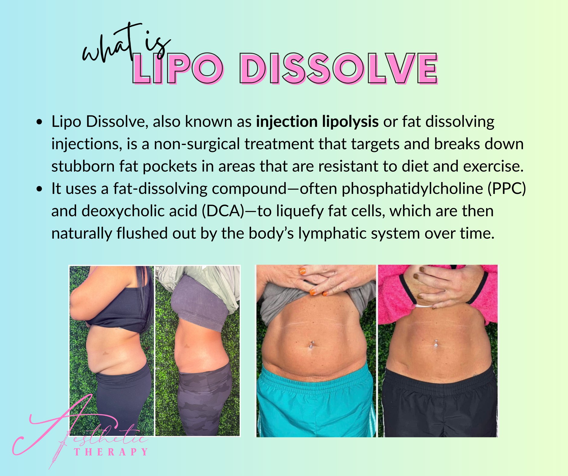 https www.realself.com question lipo-b12-injections-stomach-week Dr. Belo's new podcast episode answers ALL your lipo questions Vitamin B12 Injections for
