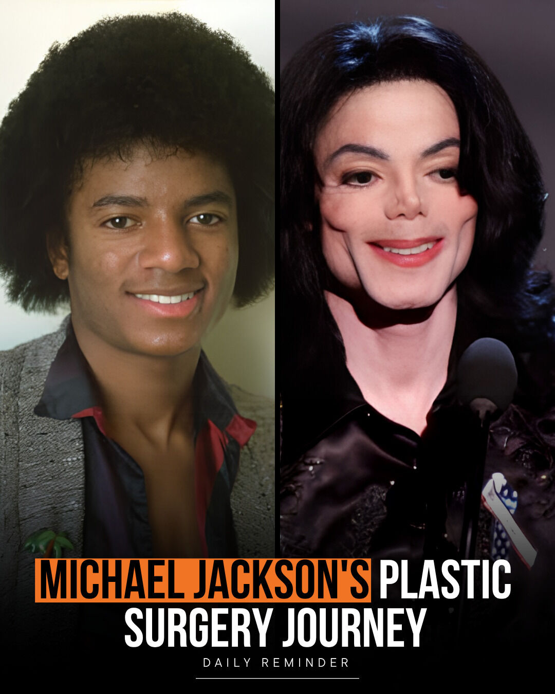 Michael Jackson plastic surgery journey