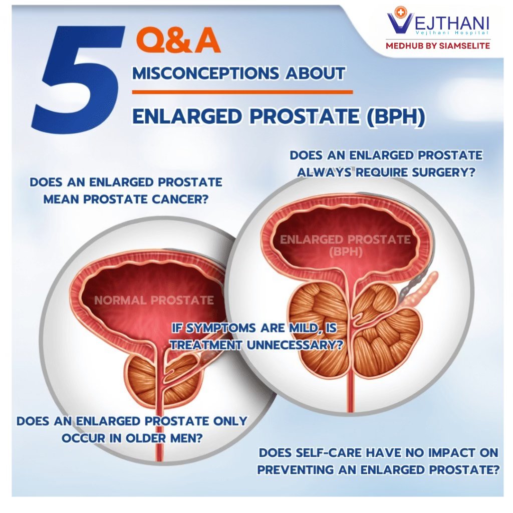 Photo inspiration: Picture Idea: Treatment 5 Misconceptions About Enlarged Prostate You May Not Know