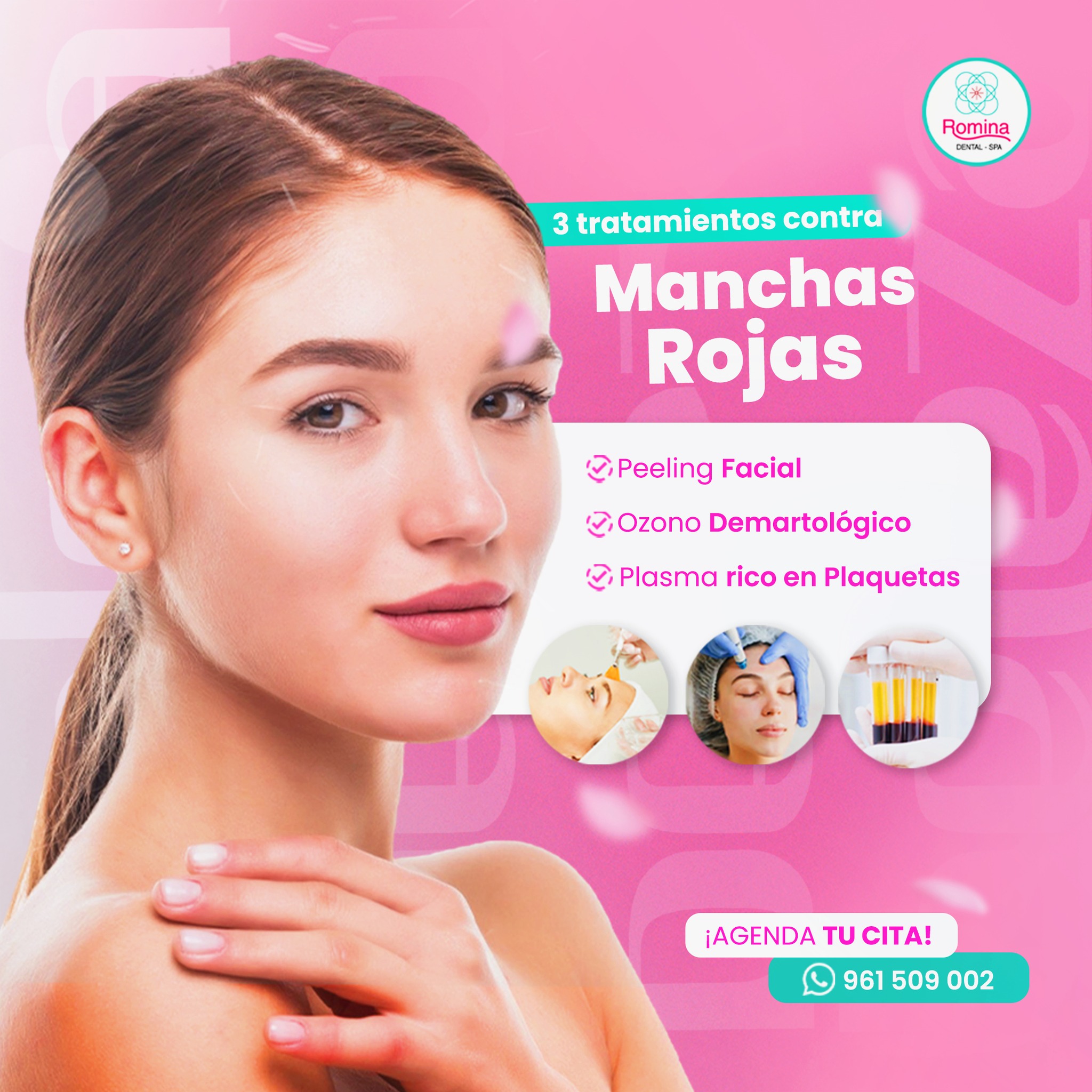 Centro - ¿Lista para decirle adiós a las manchas rojas y lucir una piel ...