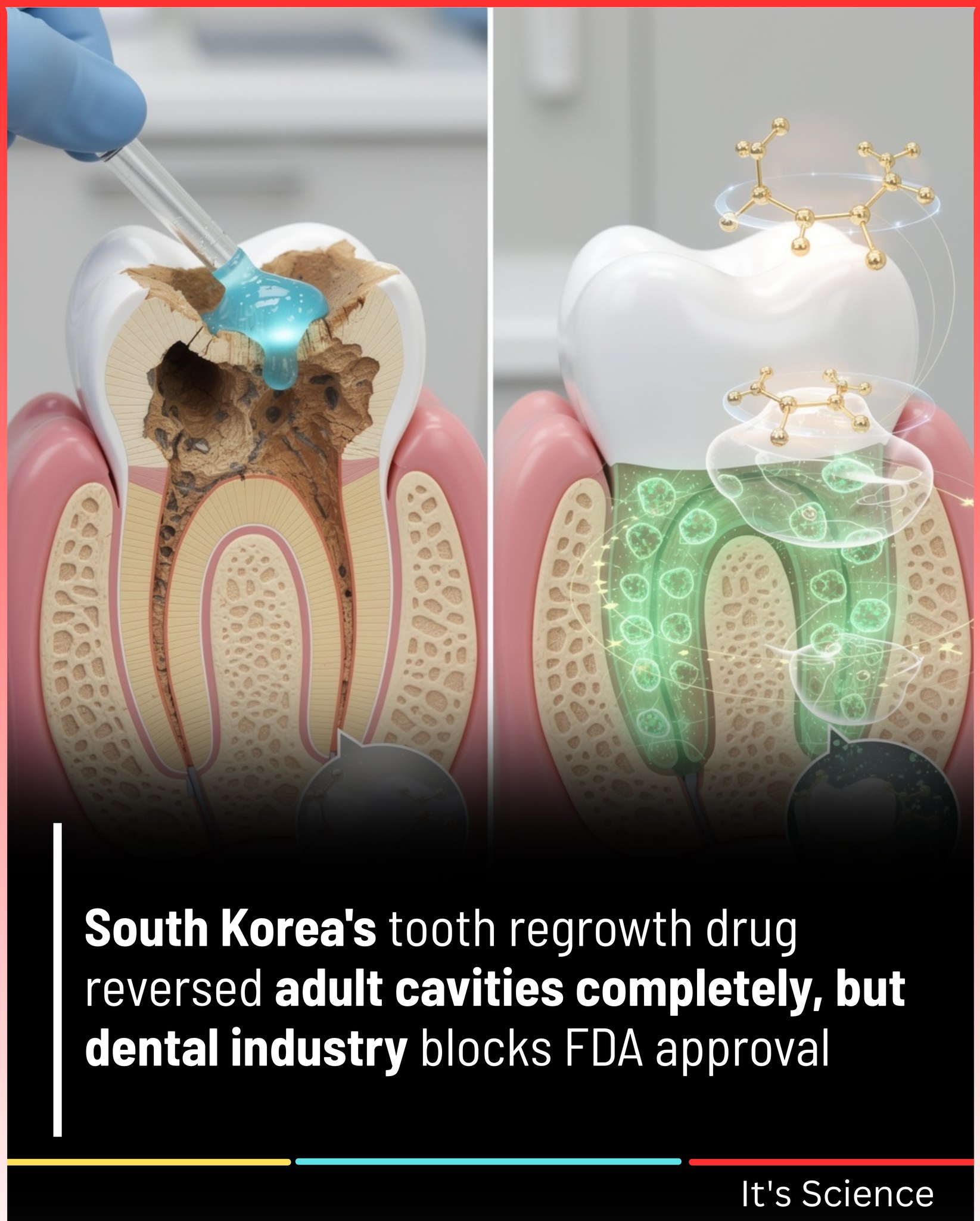 It's Science - South Korea's tooth regrowth drug reversed... | Facebook