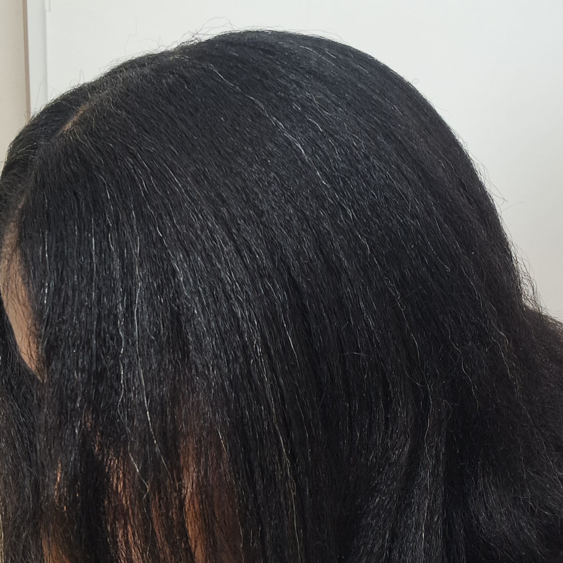 White hair is often seen as a sign of aging, but it can appear early due to several factors. Genetics, stress, hormonal changes, and nutritional deficiencies all affect melanin production, the pigment