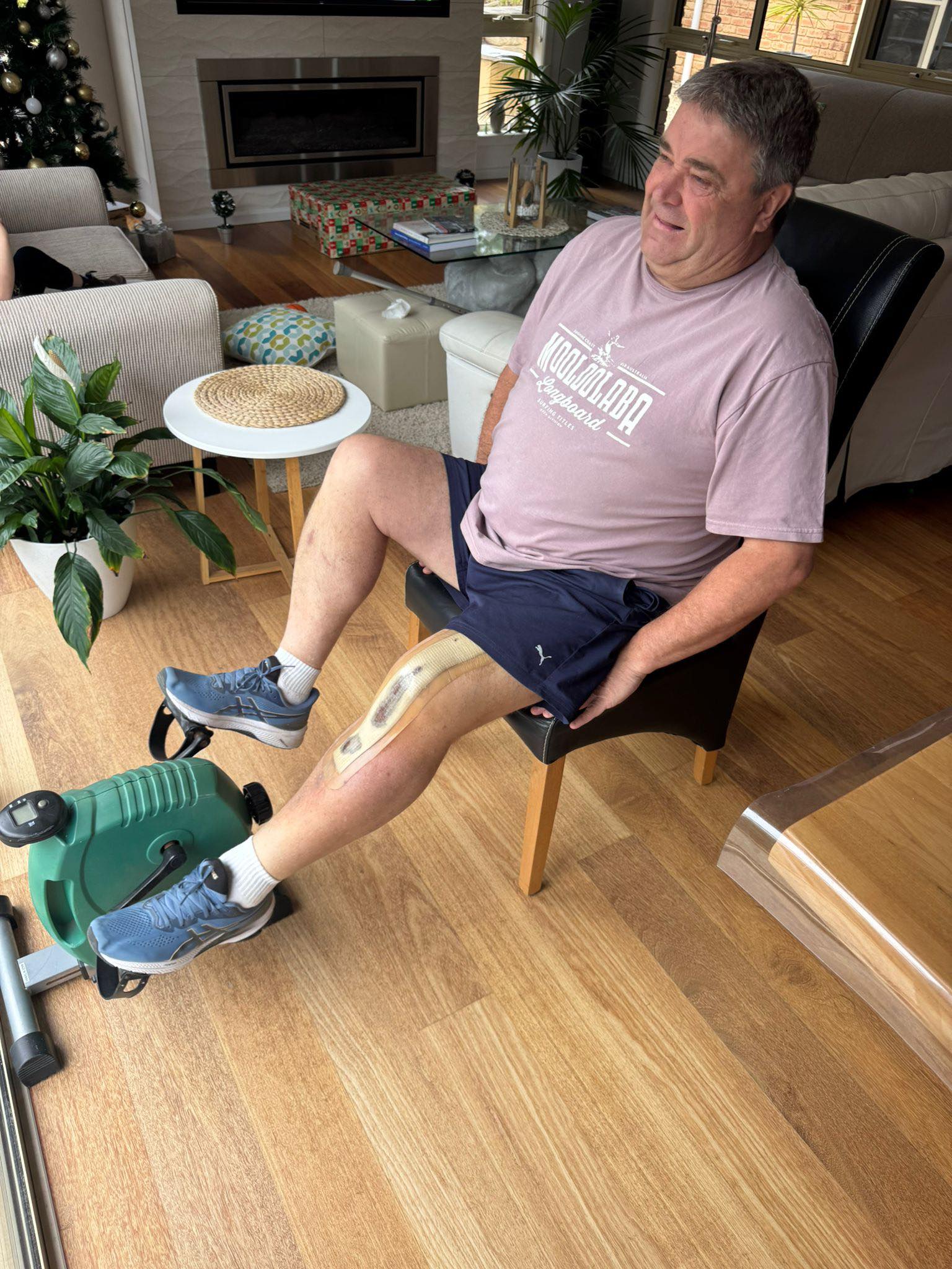 Kerry - I've hit day 9 of recovery 💪 And yes it does hurt, but getting ...