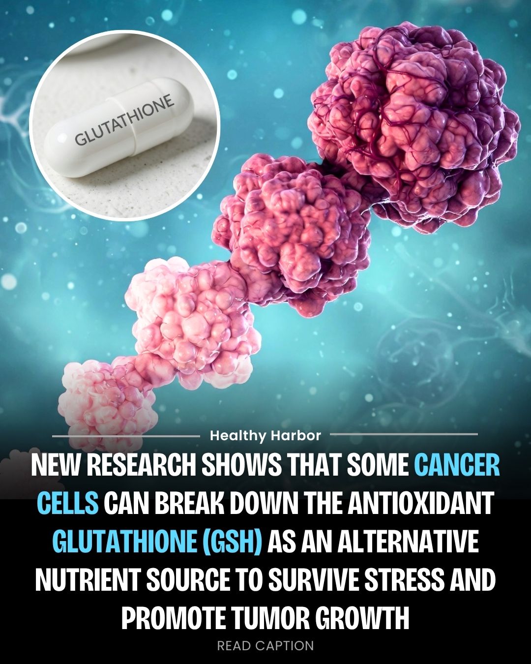 In a new study published in the top scientific journal Nature, Wilmot researchers discovered that the antioxidant glutathione fuels cancer cells. This matters because it means blocking glutathione could be a new