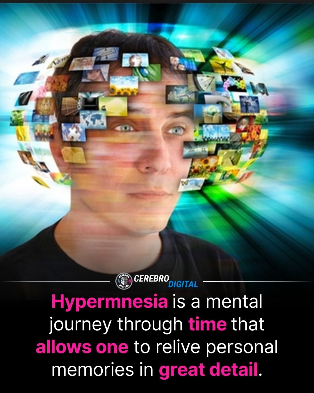 Digital Brain - A rare case of 