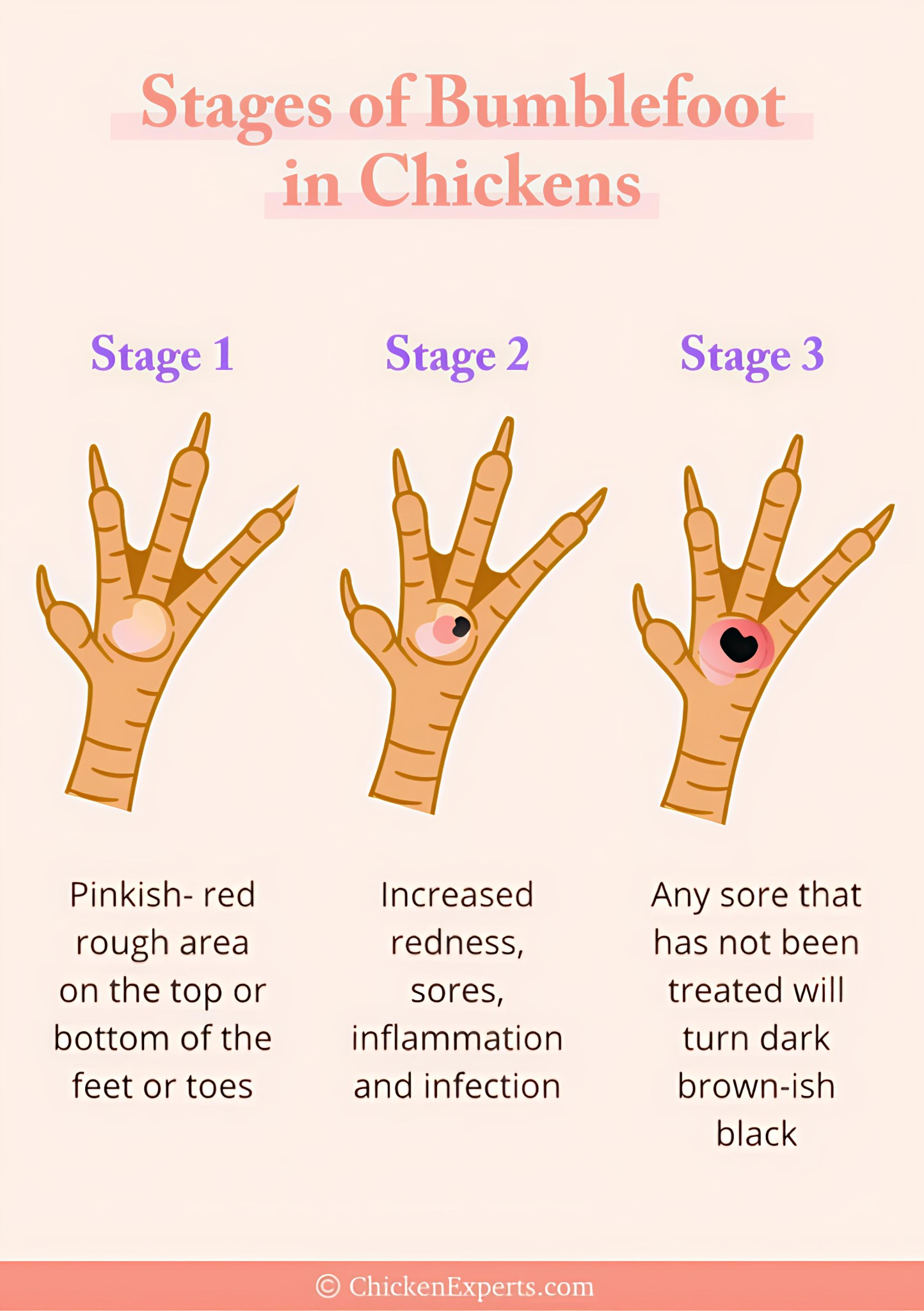 Bumblefoot stages in chickens: early detection key