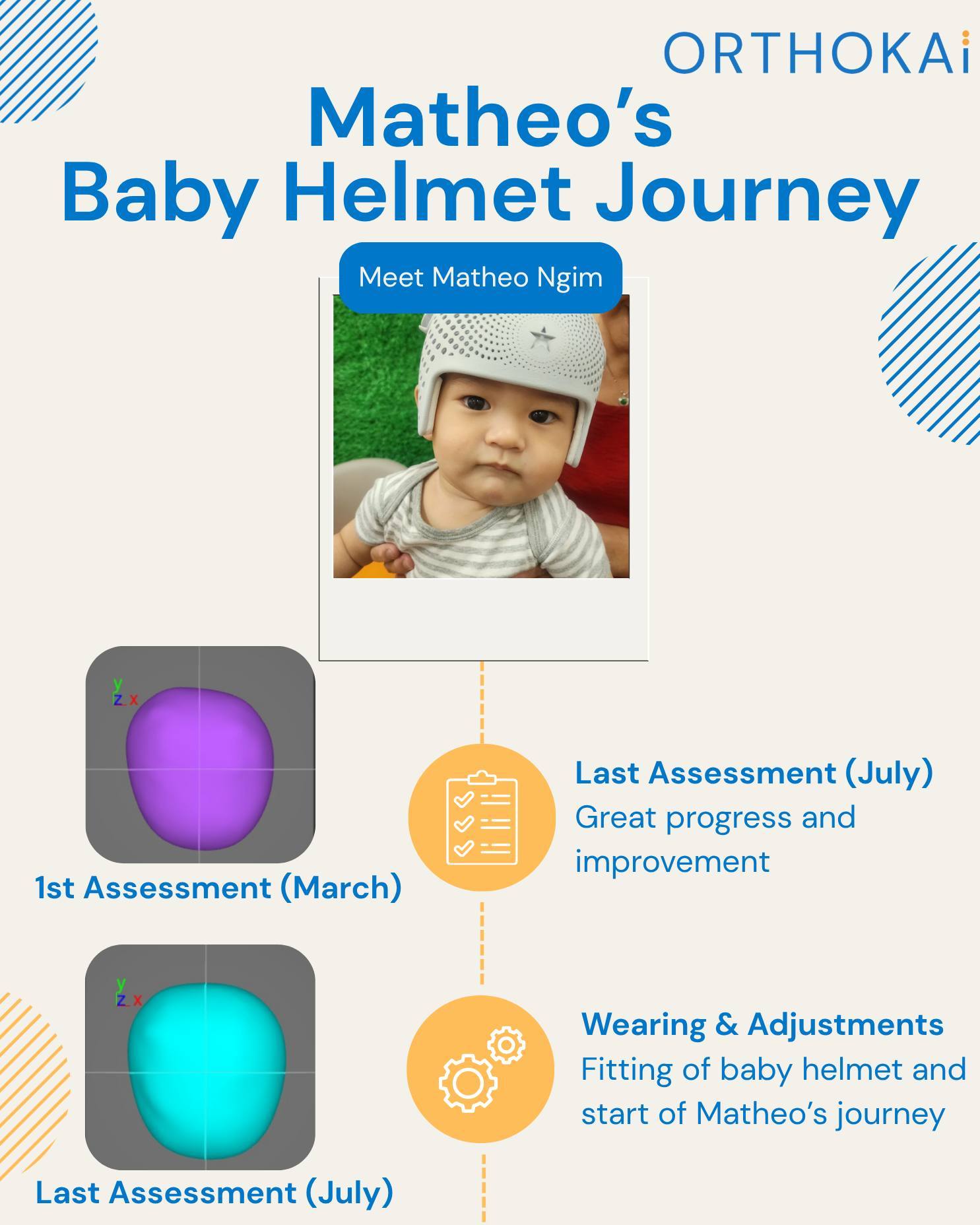 OrthoKai Baby Helmet - Flat Head Therapy | Singapore Singapore