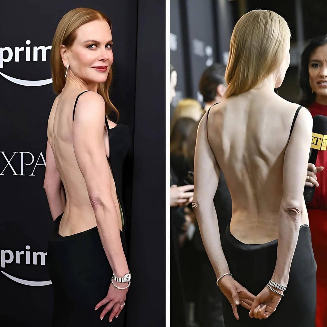 nicole kidman black backless dress stunned in a luxurious gown with a daring slit, instantly dubbed a “revenge dress.” But not everyone was impressed with the actress's style. Then again, this isn't the first Color:Brown & Green white wedding dresses A Line Short Backless