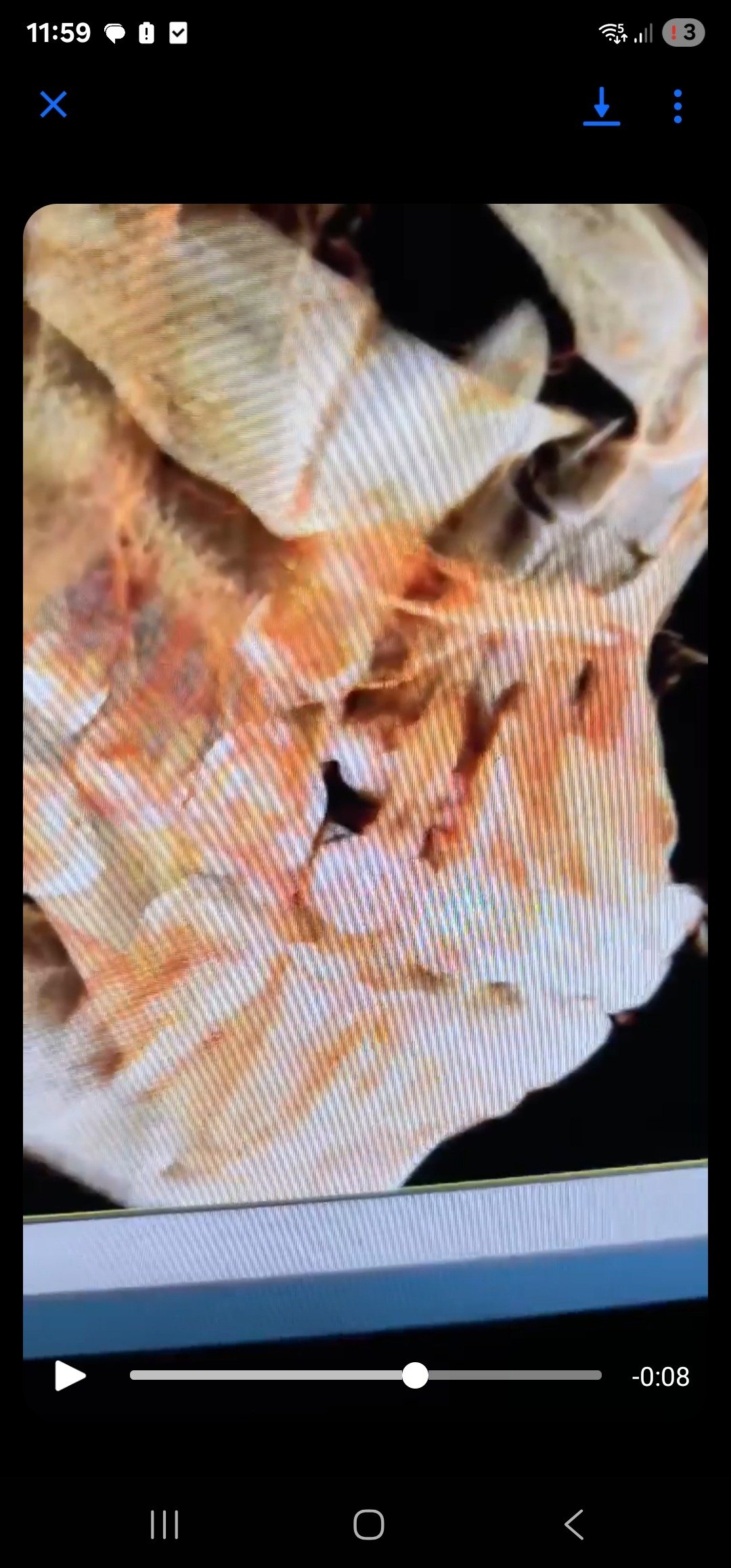 Recurring abscess after apicoectomy on canine tooth