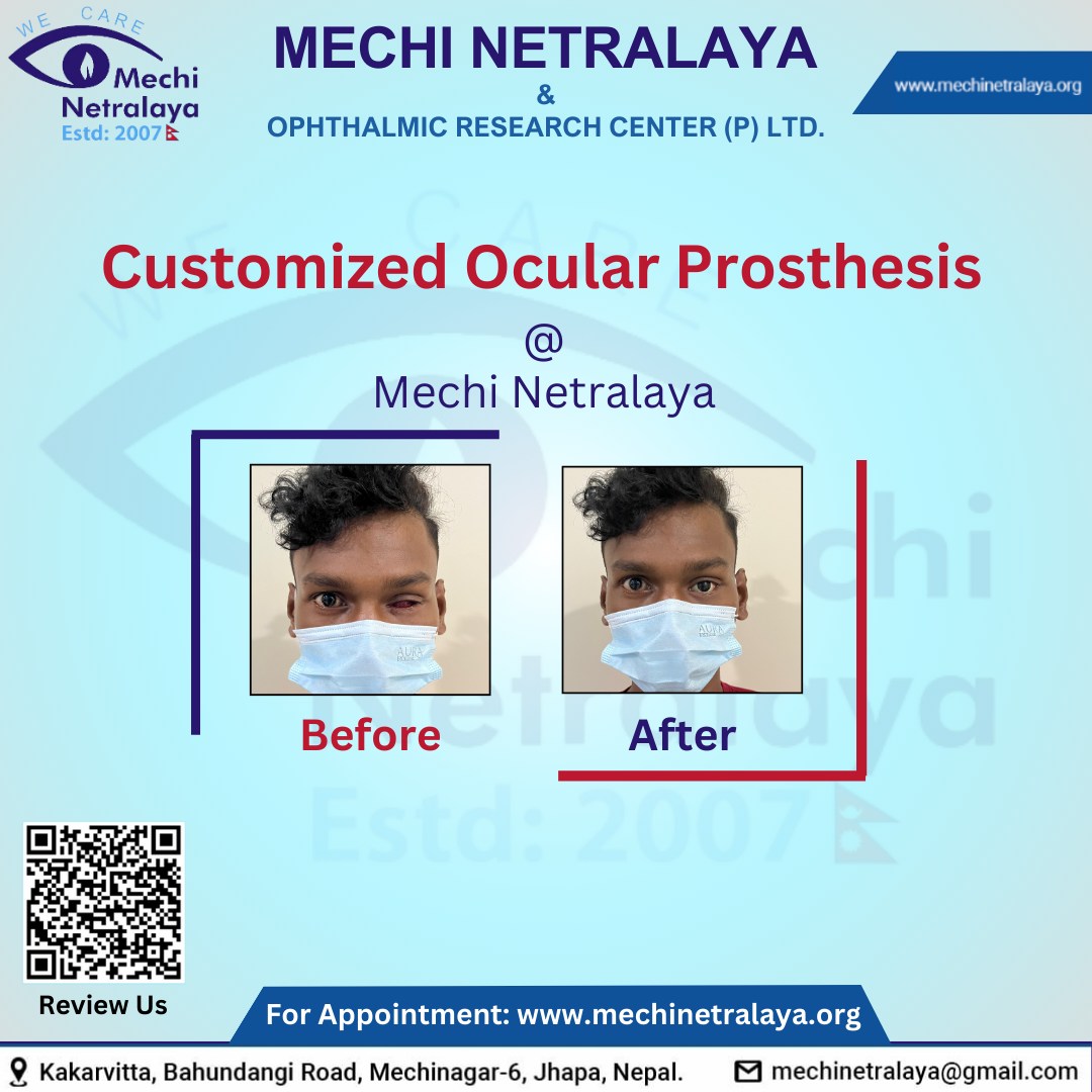 Mechi Netralaya | Jhapa District
