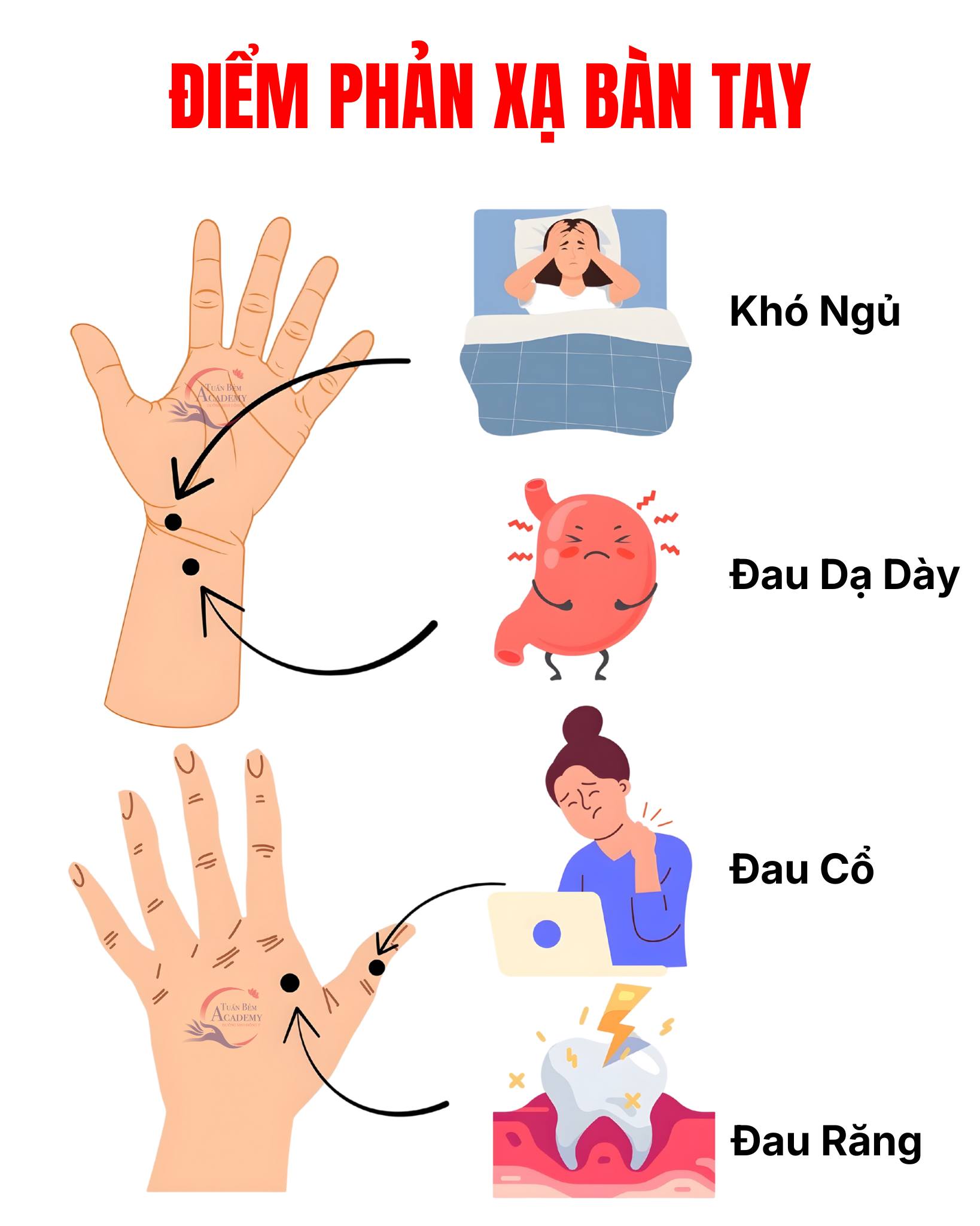 🔴 90% người bị đ:au đầu,... - Viện Dưỡng Sinh Đông Y Tuấn Bẻm | Facebook