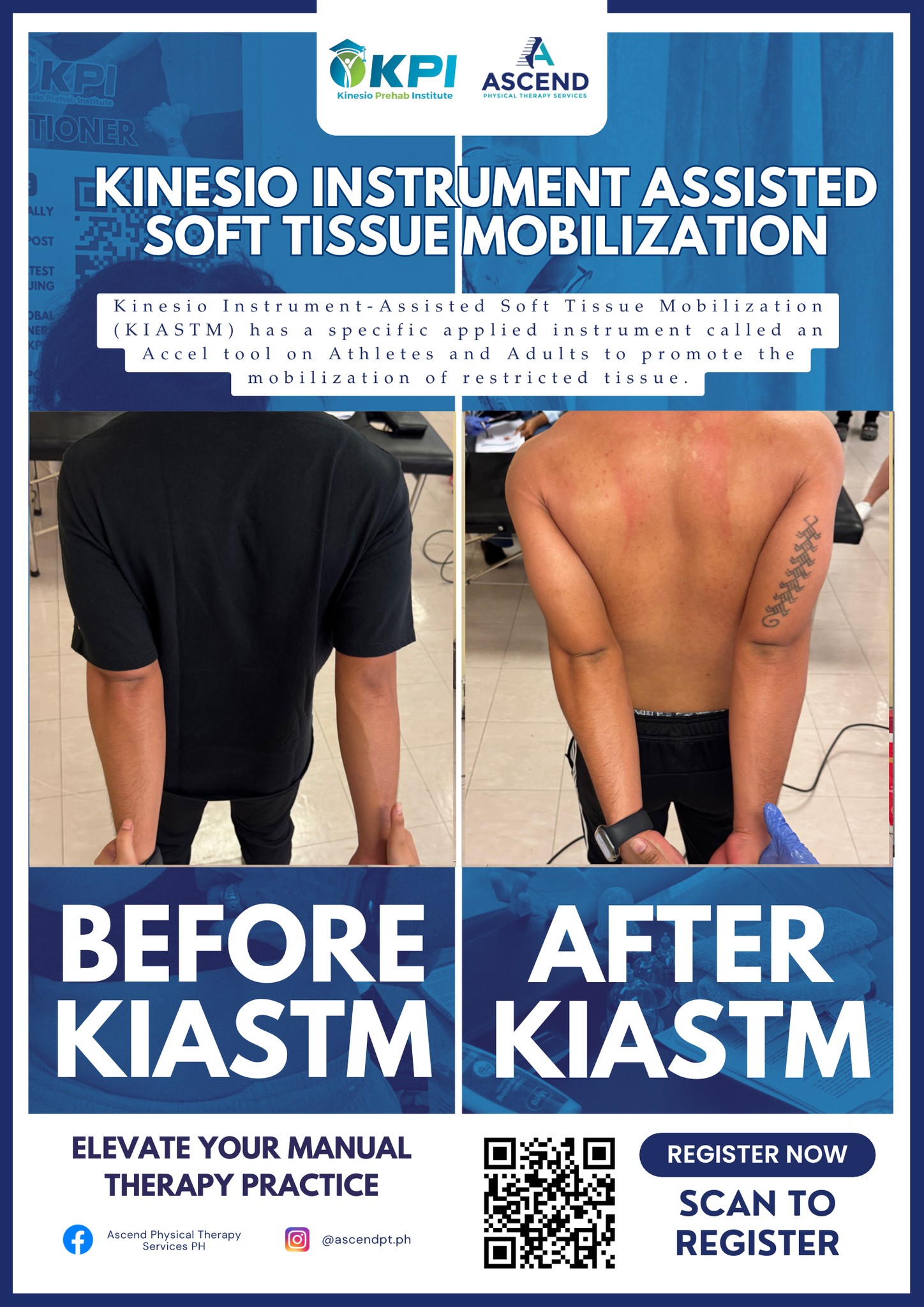 Ascend Physical Therapy Services PH - 🌟 RESULTS in JUST 1 SESSION ...