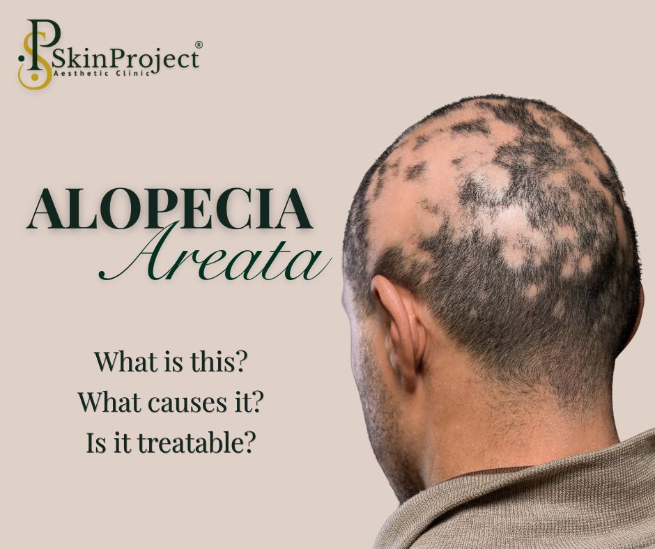 copper peptide ghk-cu alopecia study human ✨ Understanding for Cellular Wellness For Educational Purposes Only GHK-Cu is a naturally occurring complex known for its role in supporting skin and hair vitality. Learn about the potential hierarchy:Tack And Supplies>Healthcare>Medical Supplies