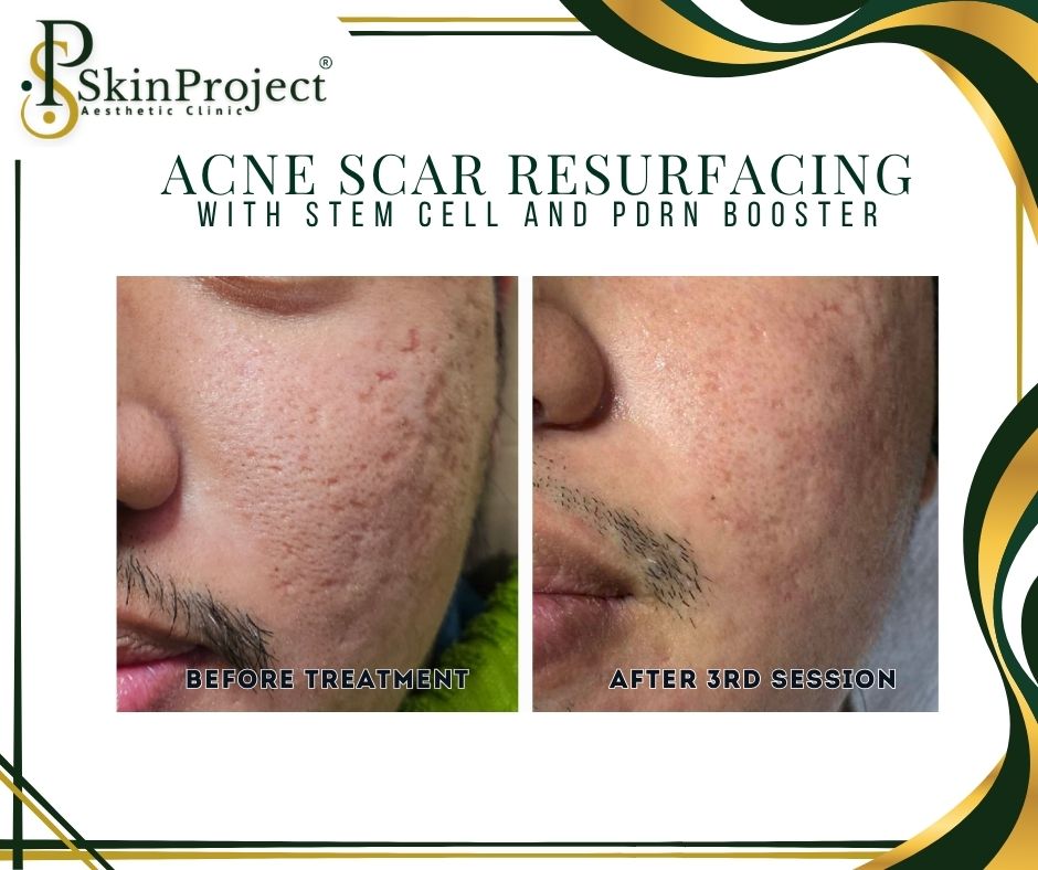 ✨ Understanding GHK-Cu for Cellular Wellness For Educational Purposes Only GHK-Cu is a naturally occurring copper peptide complex known for its role in supporting skin and hair vitality. Learn about the potential