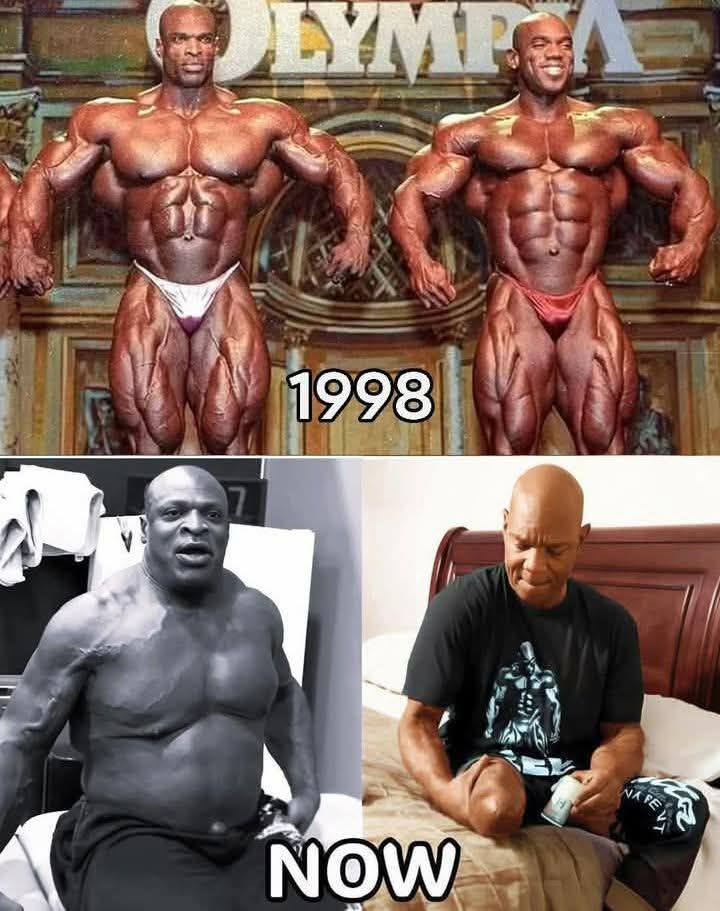 big lenny melanotan was known for his larger than life personality and his unique physique such as his distended stomach. He carved out a unique niche for himself, leading a group of bodybuilders metabolism booster supplement
