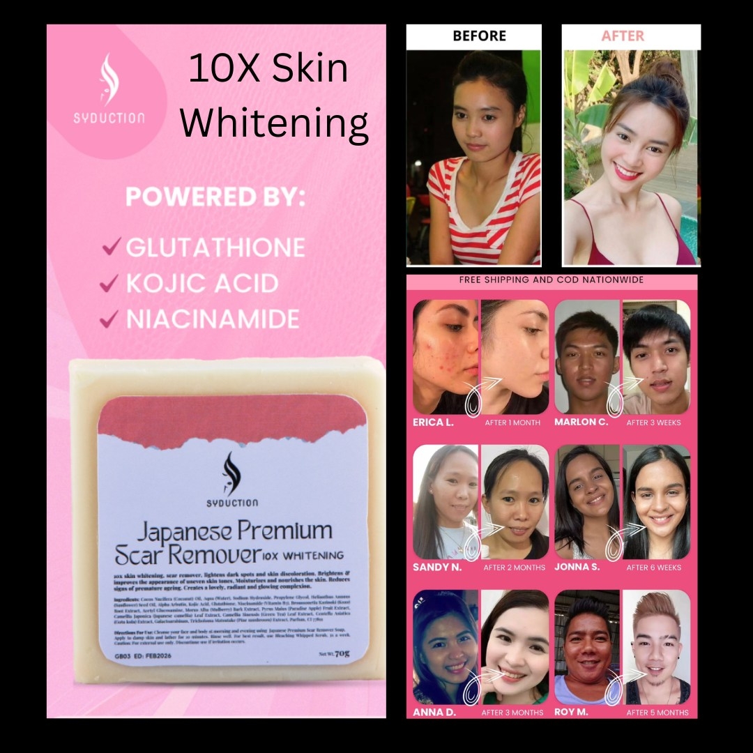 GUSTO MO NG MAPUTI, MAKINIS AT GLOWING NA BALAT? Say hello sa Bleaching ...