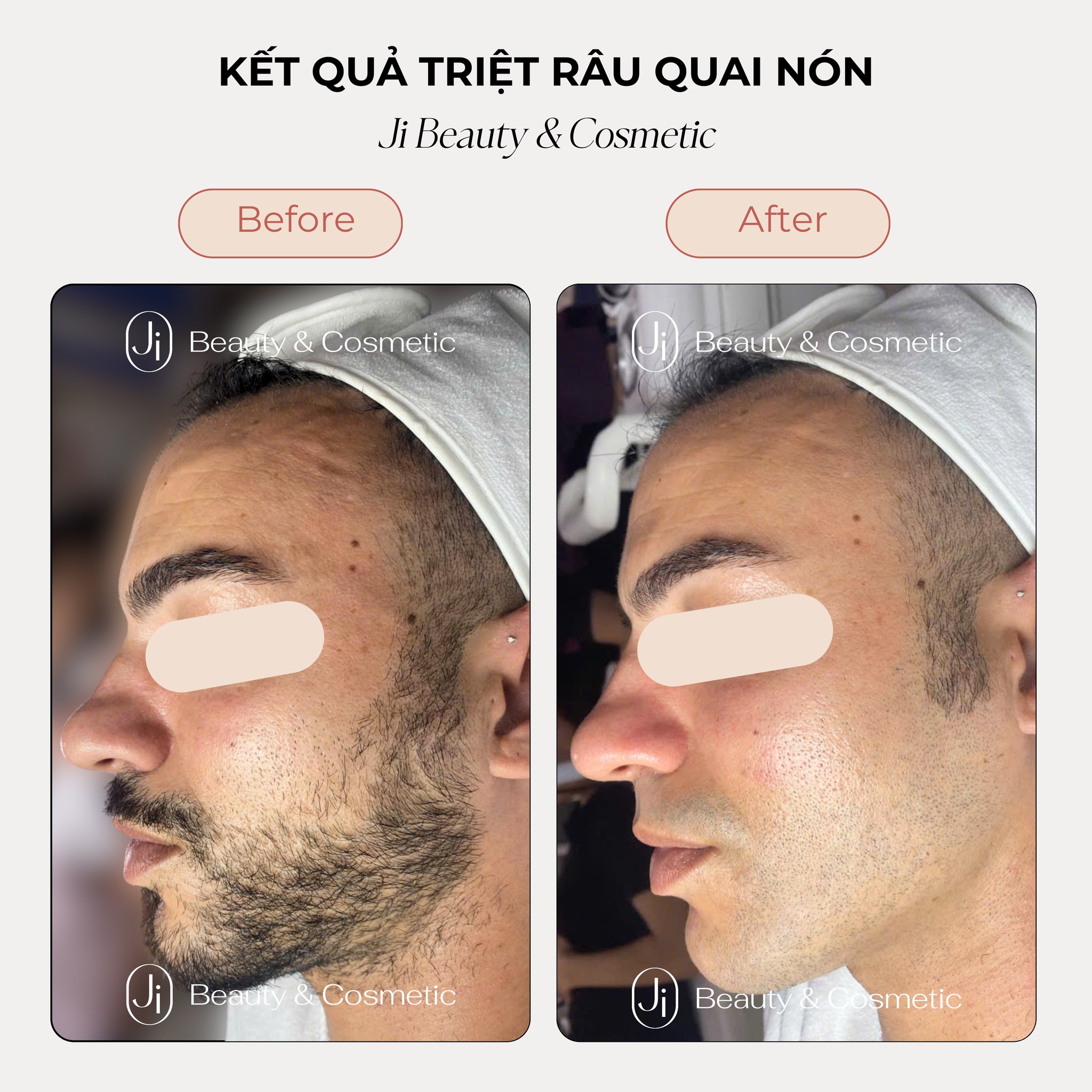Ji Beauty & Cosmetic Hà Nội | Hanoi