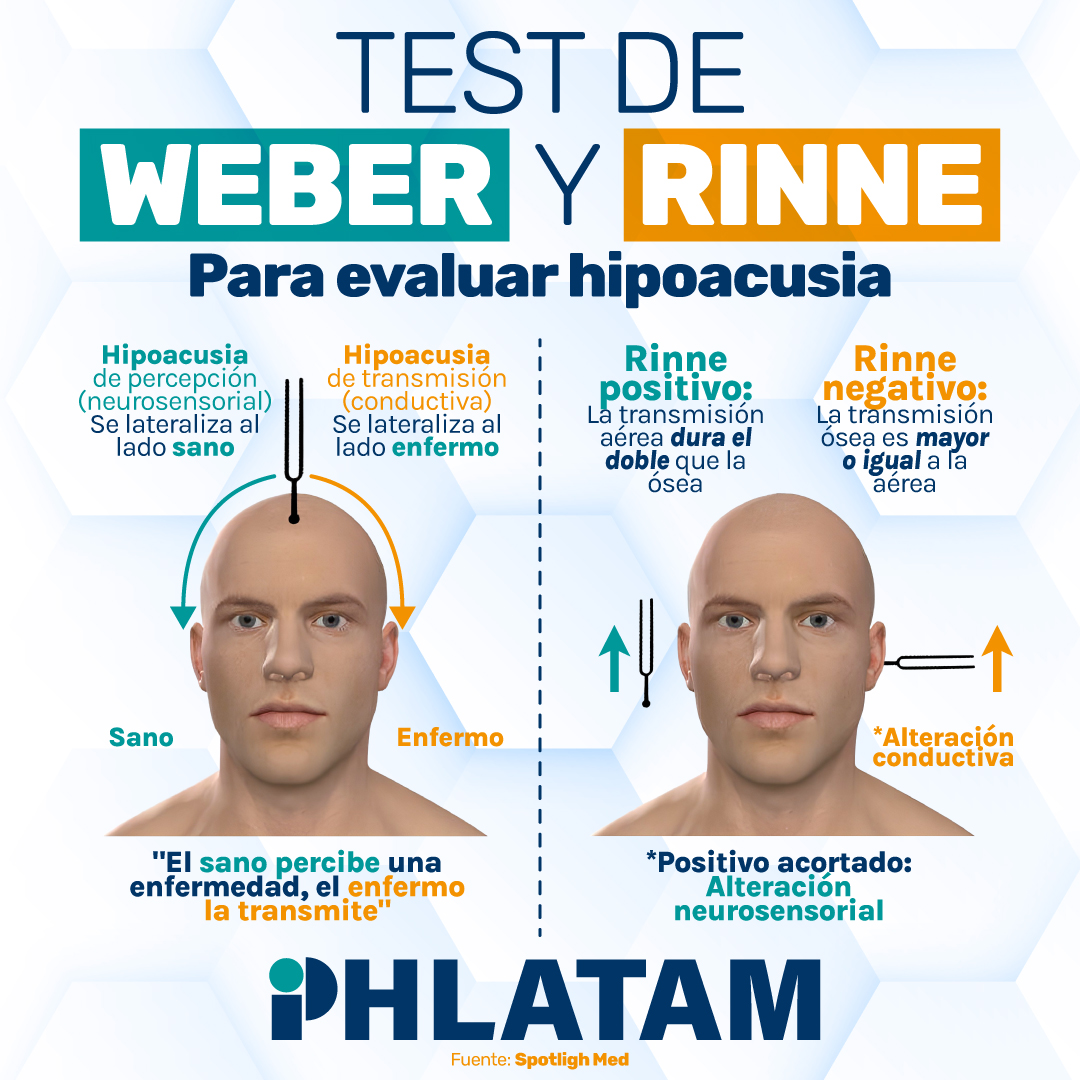 Public - #Otorrinolaringología 👂🏻 La prueba de Rinne compara la ...