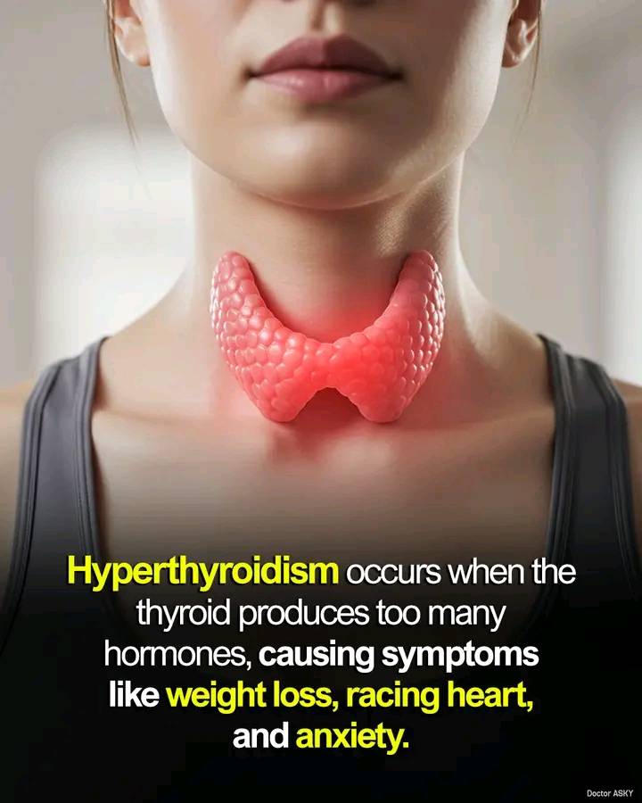 can tirzepatide cause hyperthyroidism and Let's break the drug tirzepatide down using this mnemonic cloud!  How Rapid Weight Loss from Mounjaro and Hypothyroidism: Hashimoto's Safety