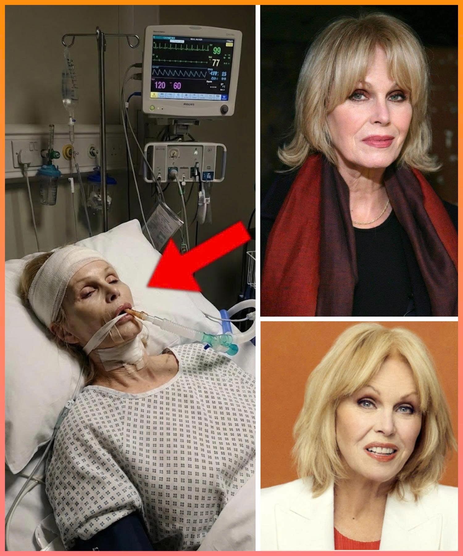 joanna lumley plastic surgery Image 9