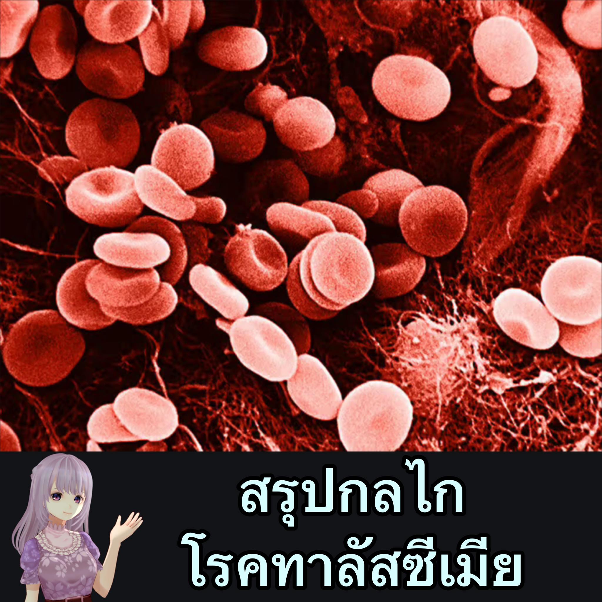 Tensia - สรุปกลไกโรคกลุ่ม Thalassemia โดยจะเน้นชนิดรุนแรง (β-thal/HbE ...