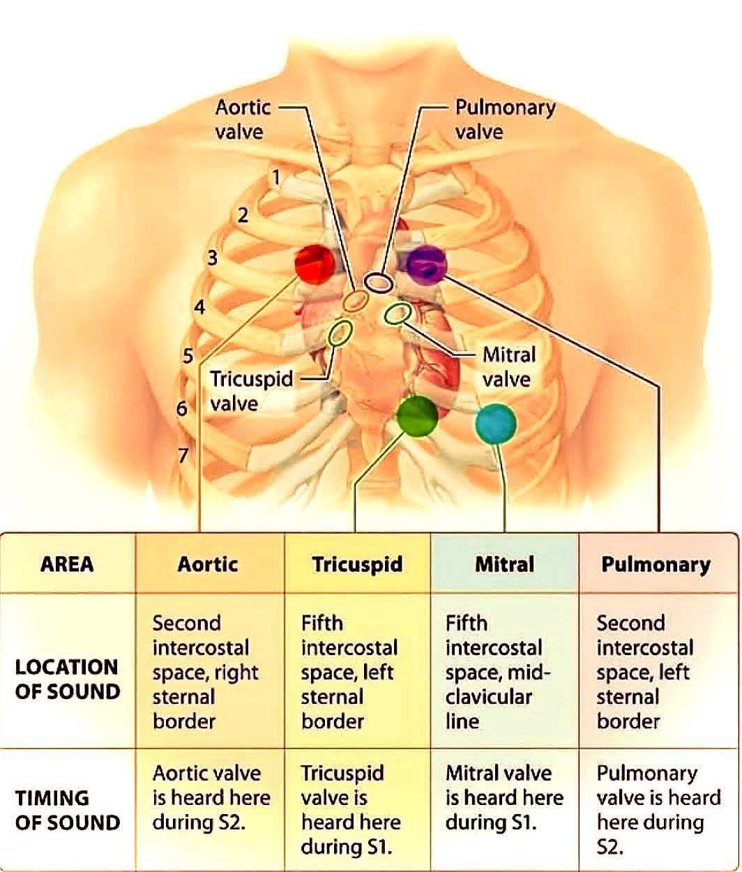 Mastering cardiac auscultation: the 