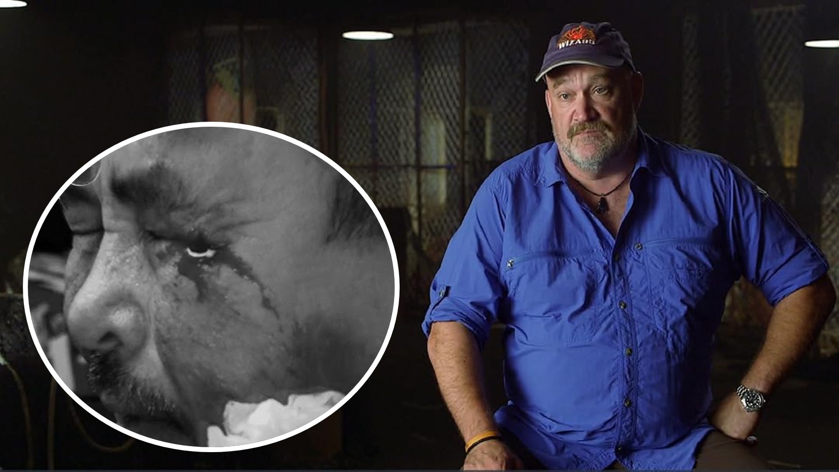 Sig’s - Crewman Nearly Loses an Eye in Accident on The Wizard — How ...