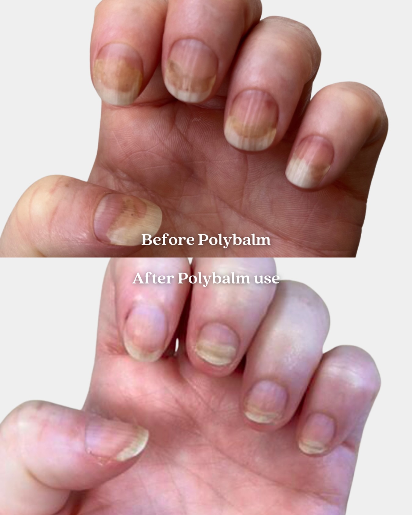 Polybalm