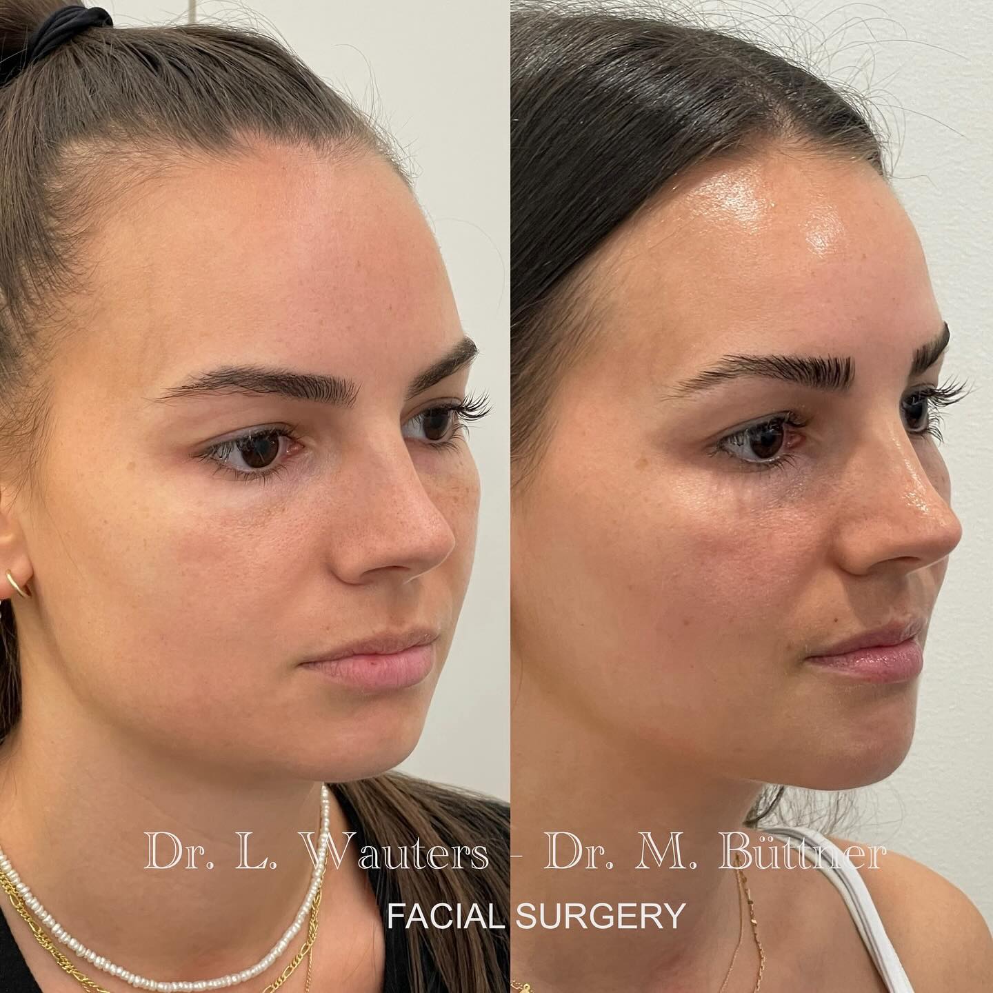 docteur-lauri-wauters-brussels-facial-surgery