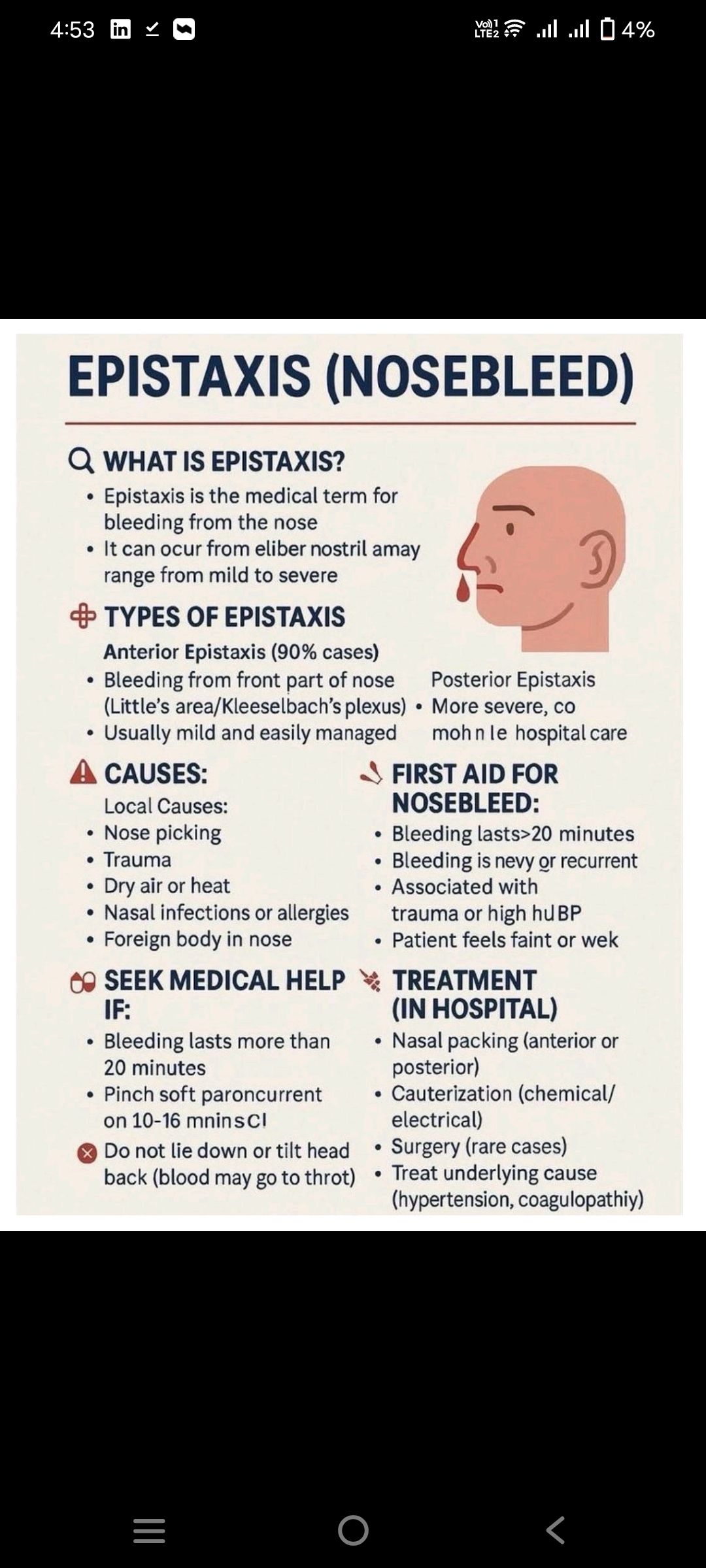 Nose bleeding 4:53 4% EPISTAXIS (NOSEBLEED) WHAT EPISTAXIS? Epistaxis the medical term for bleeding nose Itcar ocur from eliber nostril amay from mild severe + TYPES OF EPISTAXIS Anterior Epistaxis (90% cases)