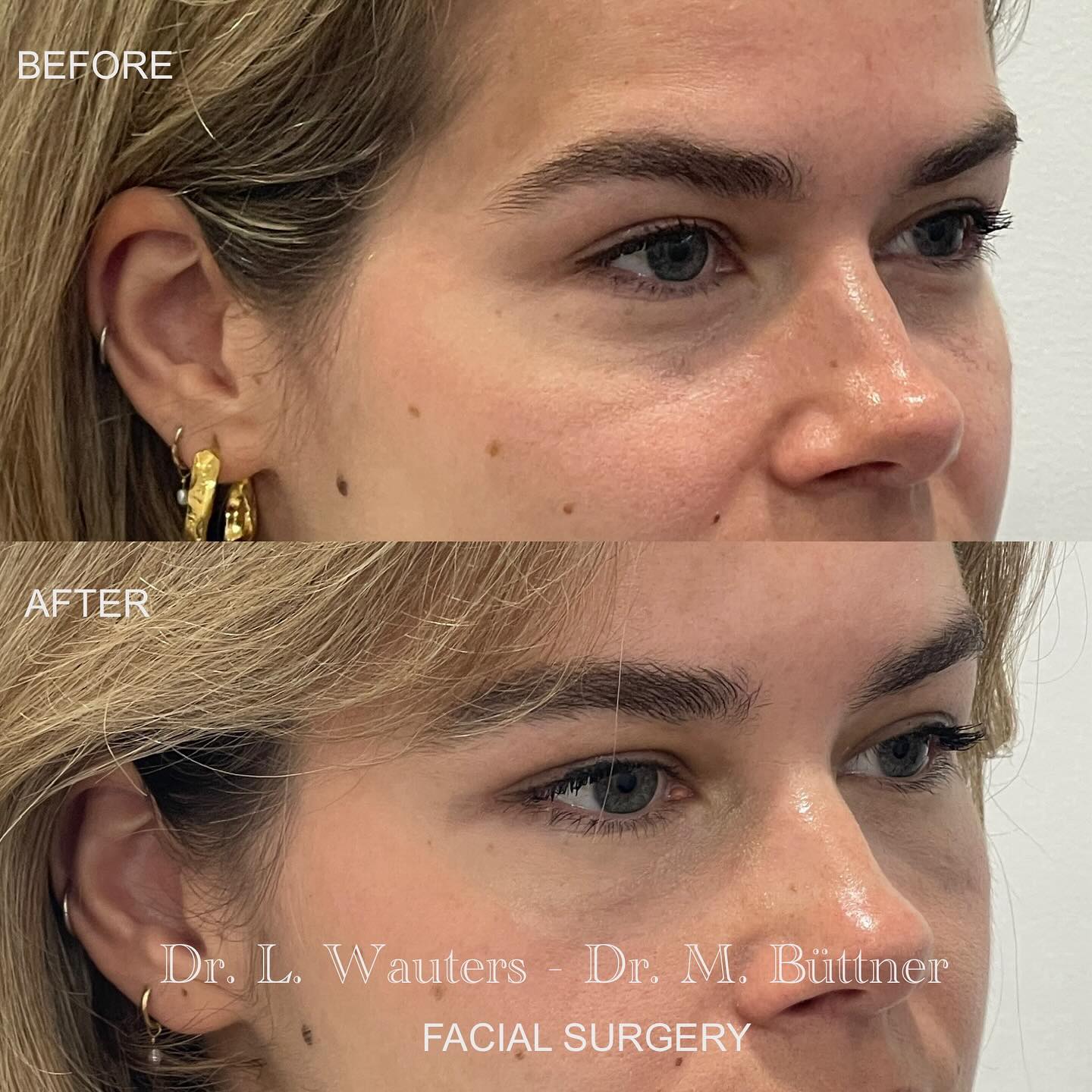 docteur-lauri-wauters-brussels-facial-surgery