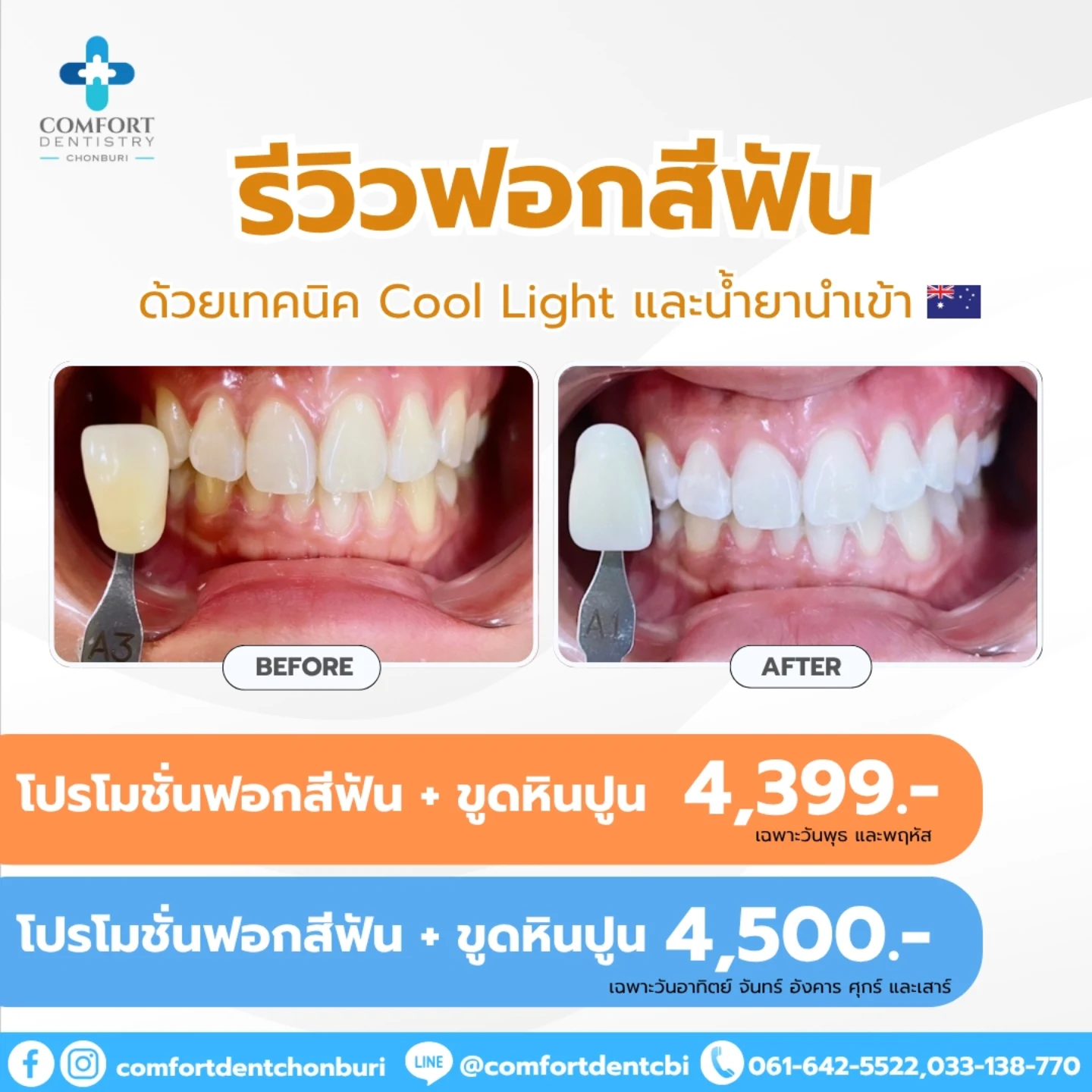 Comfort - 🧡โปรฟอกสี 4,399.- 🩵โปรฟอกสี 4,500.- รวมขูดหินปูน ตัด ...