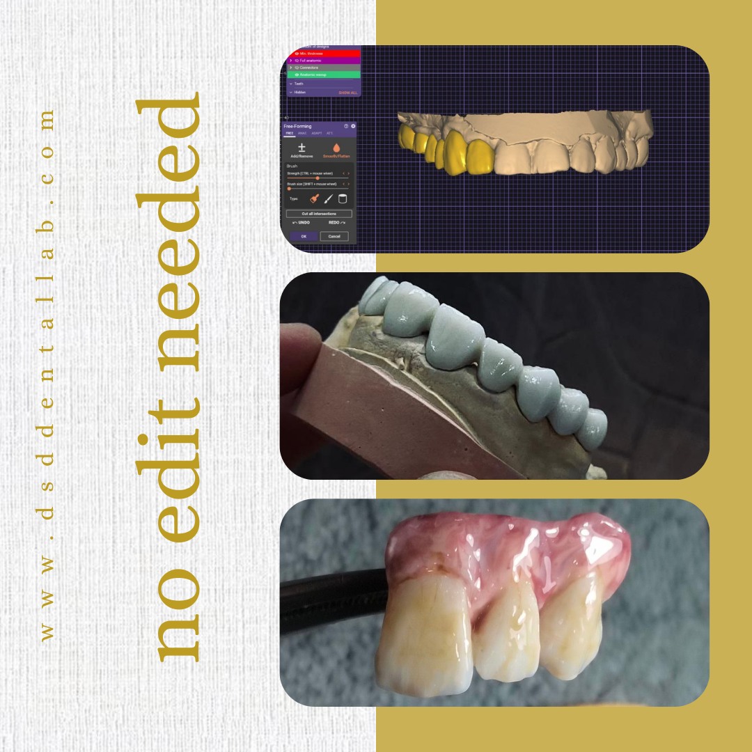 DSD - 🦷💎Transforming smiles, one case at a time! At DSD Dental Lab, our ...