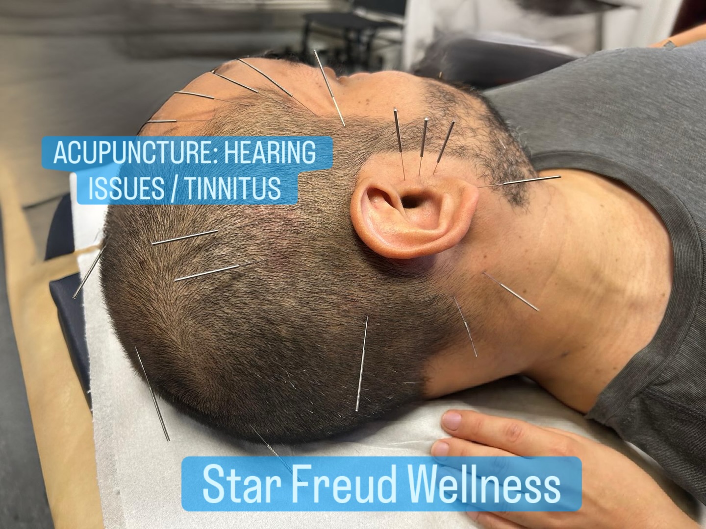 Star - If ringing, buzzing, muffled hearing or pressure in the ears is ...