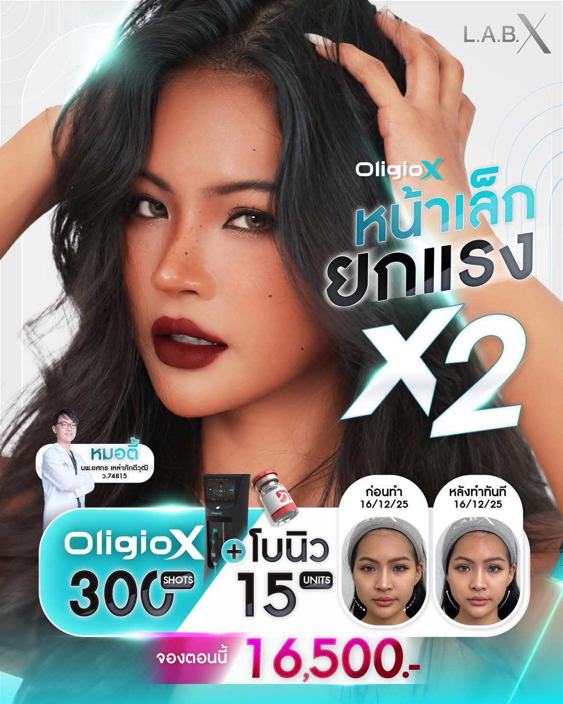 LABX Laser Center เลเซอร์ Pico หน้าใส หลุมสิว ฝ้า กระ | Nonthaburi