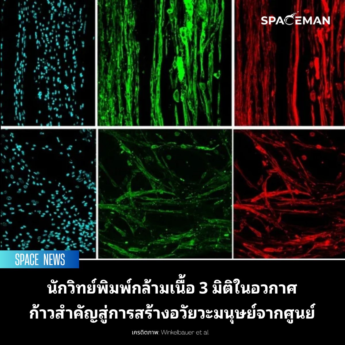 Spaceman - นักวิทย์พิมพ์กล้ามเนื้อ 3 มิติในอวกาศ ก้าวสำคัญสู่การสร้าง ...