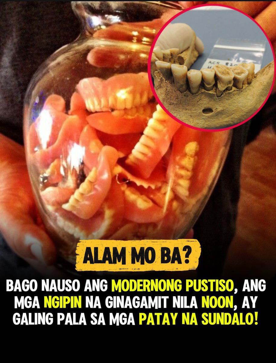Amazing - Alam niyo ba na noong ika-19 na siglo, ang mga pustiso ay ...